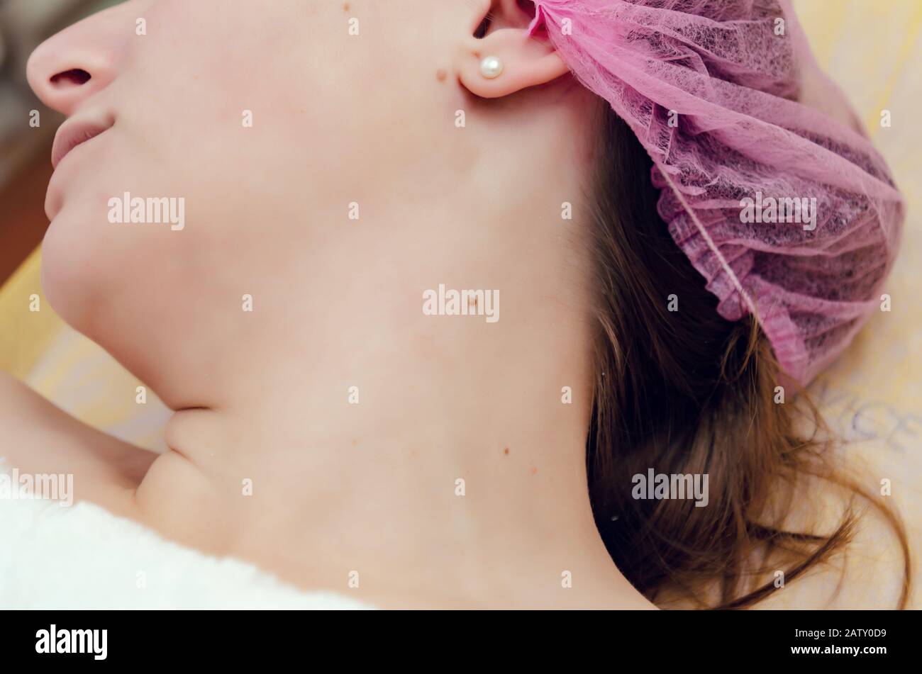 Retrait des papillomes sur le cou dans un salon de beauté. Banque D'Images