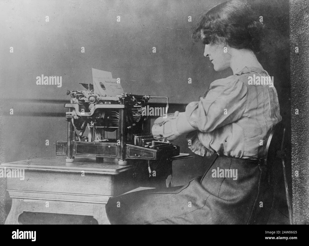 Irene Cornyn à une machine à écrire. Elle porte une prothèse sur son bras et utilise peut-être une machine à écrire modifiée CA. 1910-1915 Banque D'Images