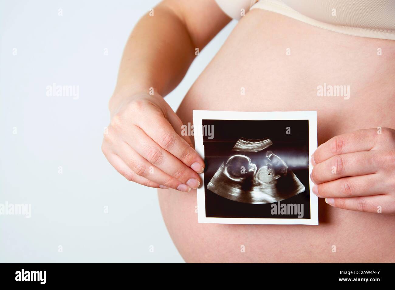 Scanner De Bebe Banque D Image Et Photos Alamy