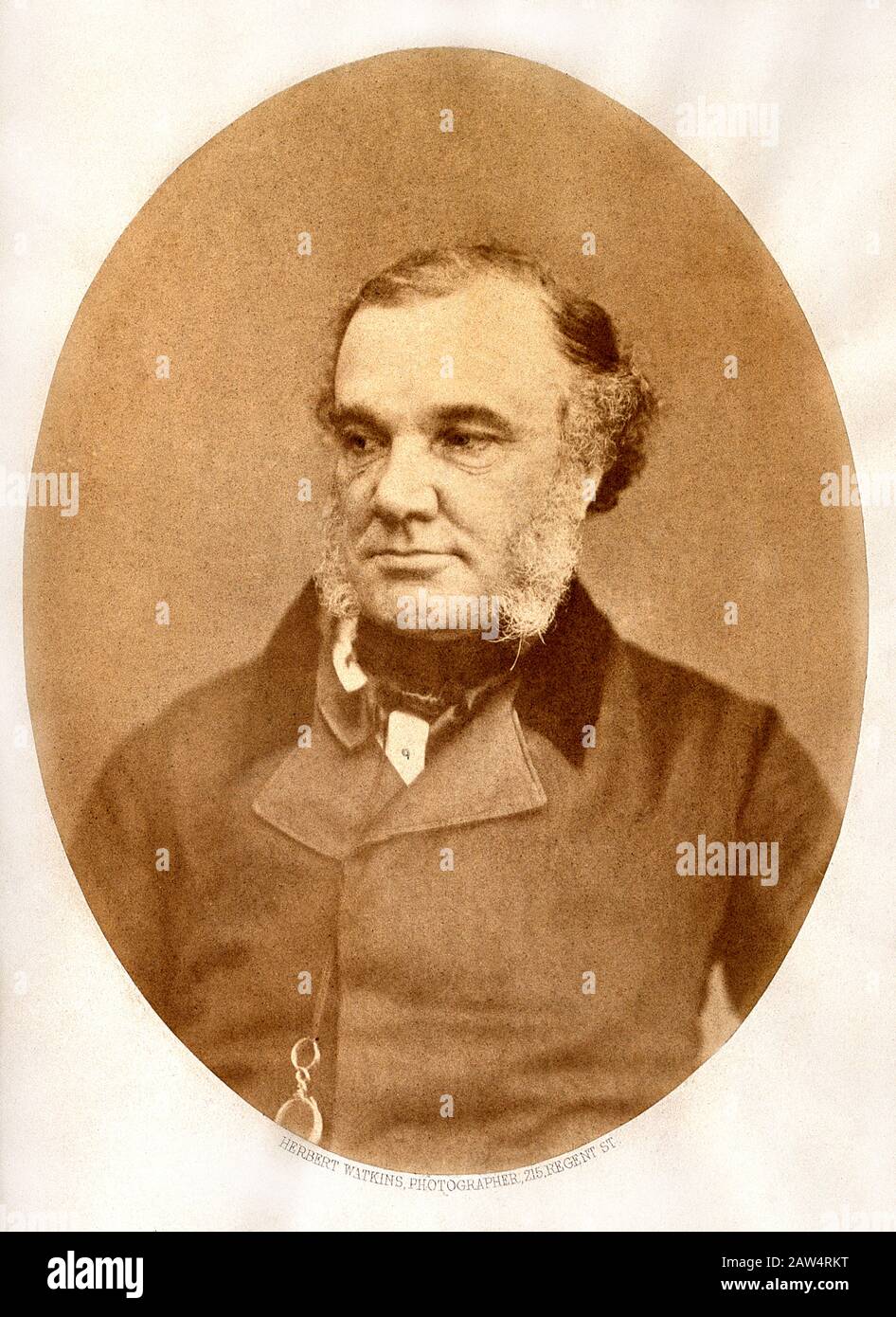 1850 CA , GRANDE-BRETAGNE : the british Thomas Addison ( 1793 – 1860), grand médecin et scientifique réputé à l'hôpital Guy à Londres . Photo par Banque D'Images