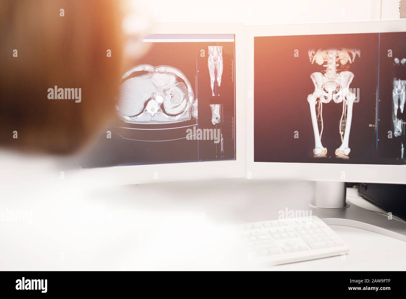 Imagerie par résonance magnétique. Médecin traitant du cancer des résultats de l'IRM en gros plan. Banque D'Images