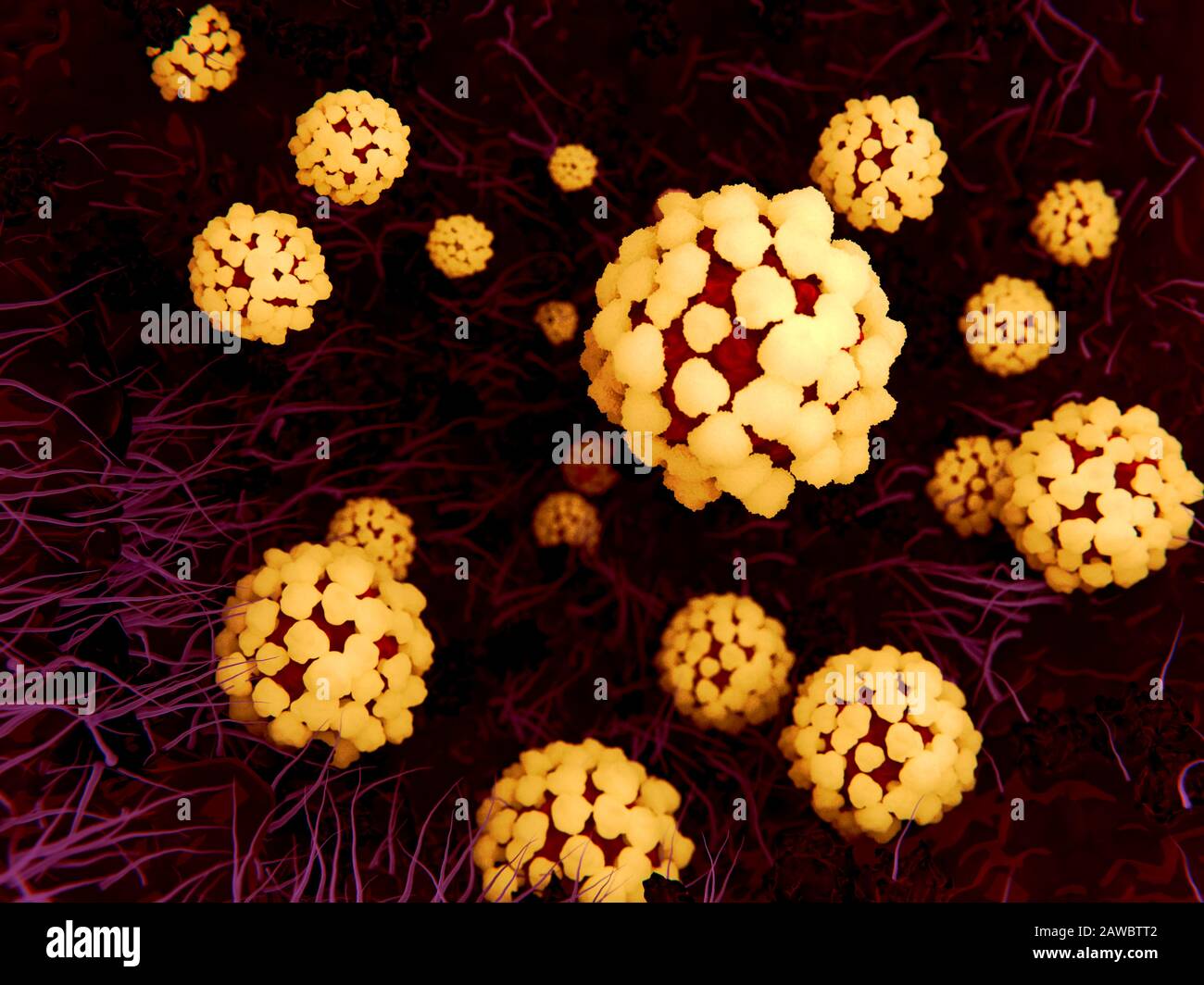 Infection pulmonaire du coronavirus, illustration Banque D'Images