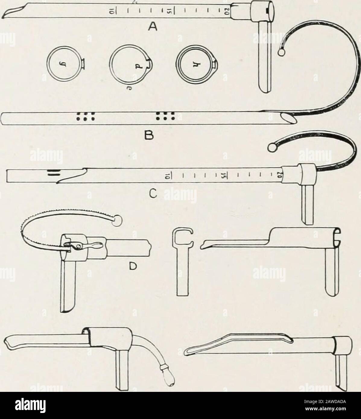 Endoscopie perorale et chirurgie laryngée . Fig. 2 et 3. Brunings deux poignées éclairantes pour laryngoscopes, bron-chooscopes et oesophagoscopes. Ingals utilise une forme améliorée de son bronchoscope d'éclairement distal original (Fig. J), avec lequel il a fait un travail remarquable de mise en œuvre. .Mosher utilise des ésojiiagoscopes de très grand diamètre transversal avec illumination distale. (Fig. .5.) ICfiorts à j)roducc oesophagoscopes et gastro-oscilloscopes jointés et angulaires continuent, et tout cela devrait être encouragé (à condition que de grands soins soient exercés) parce que tous les efforts ont pour résultat une attention accrue à toi Banque D'Images