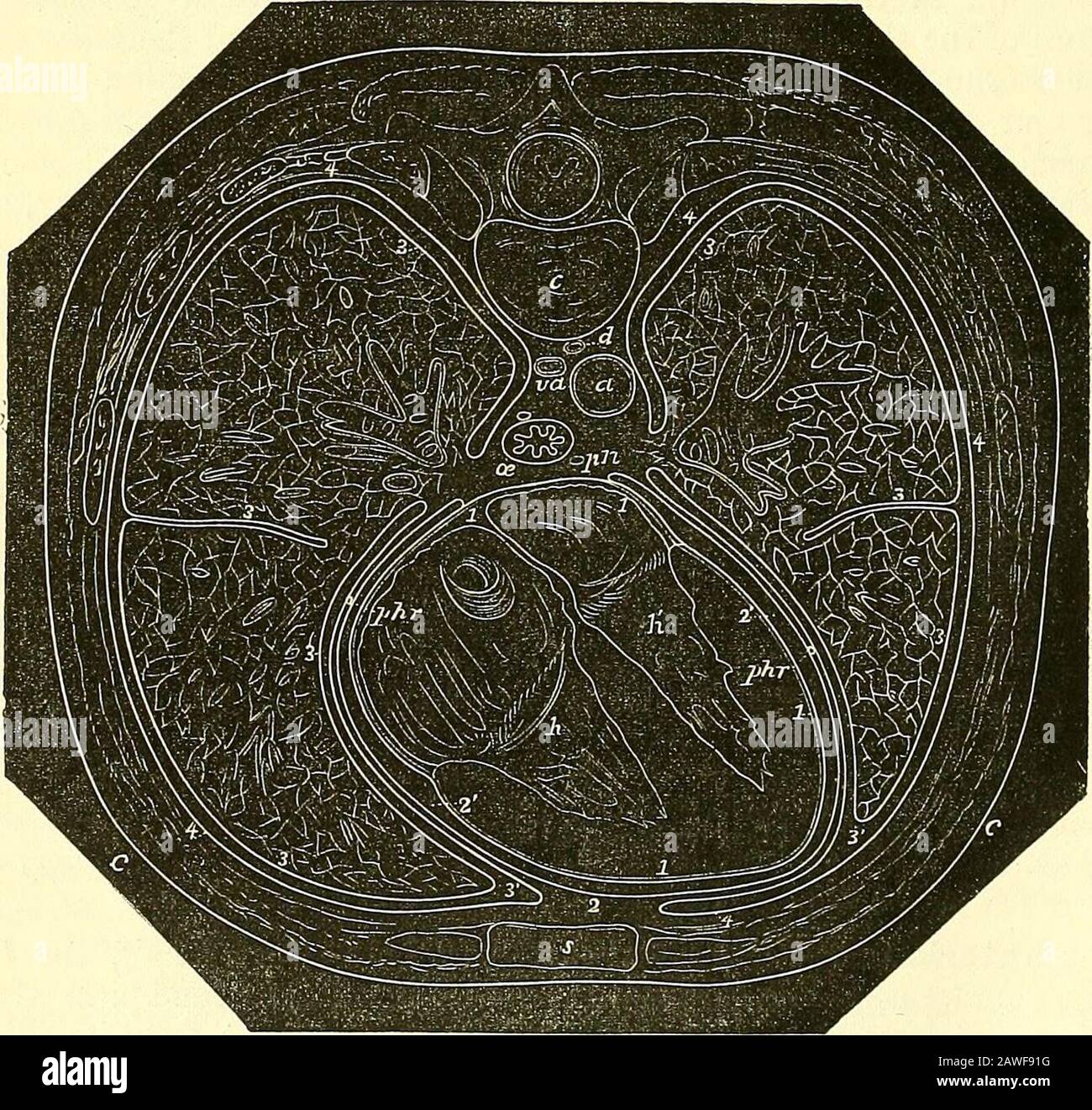 Les éléments de l'anatomie de Quain . du médiastin supérieur a été meublé par ProfessorThane. (E.A.S.) 478 LE PERICAEDIUM. (c'est-à-dire le cœur, la partie ascendante de l'arche de l'aorte, le tronc de l'artère pulmonaire et la moitié inférieure de la veine cave supérieure), les nerfs théphreniques et les vaisseaux qui l'accompagnent, l'arche de la veine azygos et les racines des poumons avec les glandes lymphatiques bronchiques. Le médiastin postérieur est l'espace entre le péricardiumet les racines des poumons devant et la colonne vertébrale derrière (bordure fioni theloTver des quatrième vertèbres dorsales vers le bas Avards), le bo latéral Banque D'Images