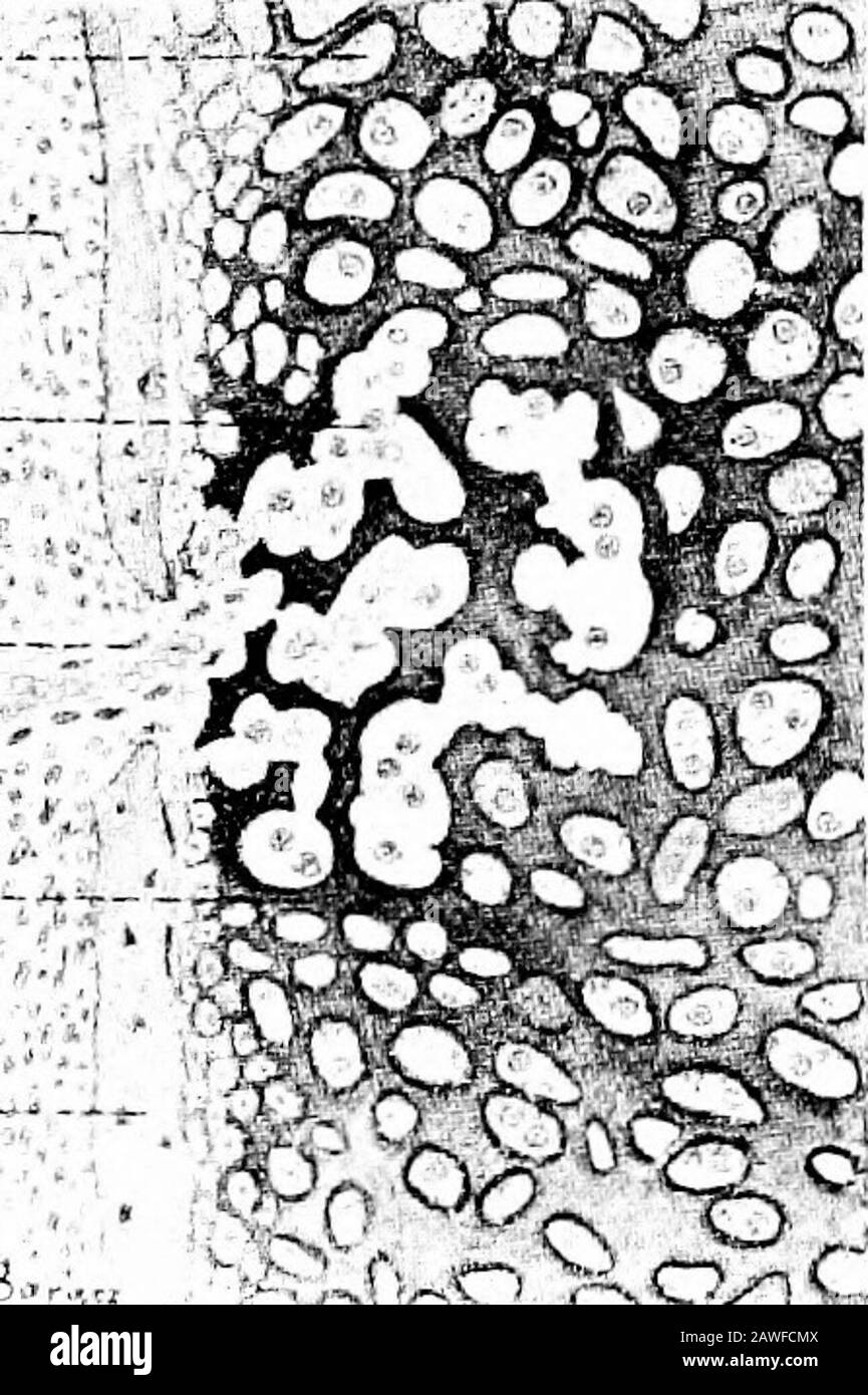 Le développement du corps humain; un manuel d'embryologie humaine . géeux en rangées (Fig. 88) et le processus de calci-fication s'étend dans le thétabéculaire de la matrice qui sépare ces lignes. Les processus de Whilething ont lieu le mesen-chyme entourant le thecartilage est devenu con-verted dans un périosteum(po), semblable à celui de l'os de membrane, et les itsosteoblastes déposent un laiterof osseux (p) sur la face sur le cartilage. Les cellules de Thecartilage se décomposent maintenant de la poire à partir des intervalles be-Tween de la matrice trabéculaire calcifiée, qui forment un réseau fin de masses d'intowhich de mesen-chyme (Fig. 89 Banque D'Images
