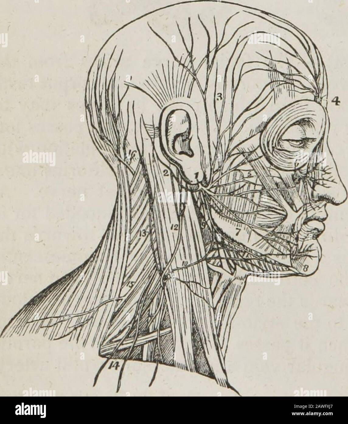 Un système d'anatomie humaine, général et spécial . nerf sont— Dans l'aqueduc ( Tympanique, Fallopii. Morda tympani. Nn • . 4 i ( auriculaire postérieur, Après avoir émergé à la ) ct 1 u • j stylo-mastoïde foramen, ) -p. ^ . &lt; y J (D gastrique. Sur le visage, Temporo-facial, J ( Pervico-facial. F,g- 175* la branche tympanique est une petite distribution de filament au muscle stapedius. Le Chorda tympaniquits le visage juste avant que le nerf émerge du foramen stylo-mastoïde, et monte par un canal distinct à la partie supérieure de la paroi postérieure du thetympanum, où il enterscette cavité à travers l'anope Banque D'Images