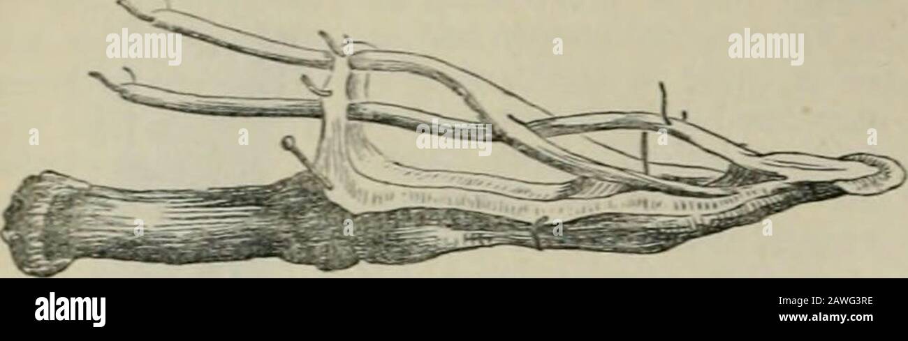 L'encyclopédie des chambres; un dictionnaire de la connaissance universelle . condphalanges des lingers, chacun des tendons se fractionnant à l'itsterination, pour donner le passage aux tendonssemblables du muscle flexor profond ou ?perforant, Mhich passesde la partie supérieure de l'ulna à insérer intole dernier phalanx de chaque doigt. Ce arrangedu tendons des muscles fléchisseurs de su{)erficiel et profond est tiraillé dans la fig. 6. Ces muscles flexor sont antagonisés par le muscle extenseur commun des doigts, qui, comme les flexors, se divise en quatre tendons, un pour chaque doigt. En outre, il existe un extenseur sjiecial isa Banque D'Images