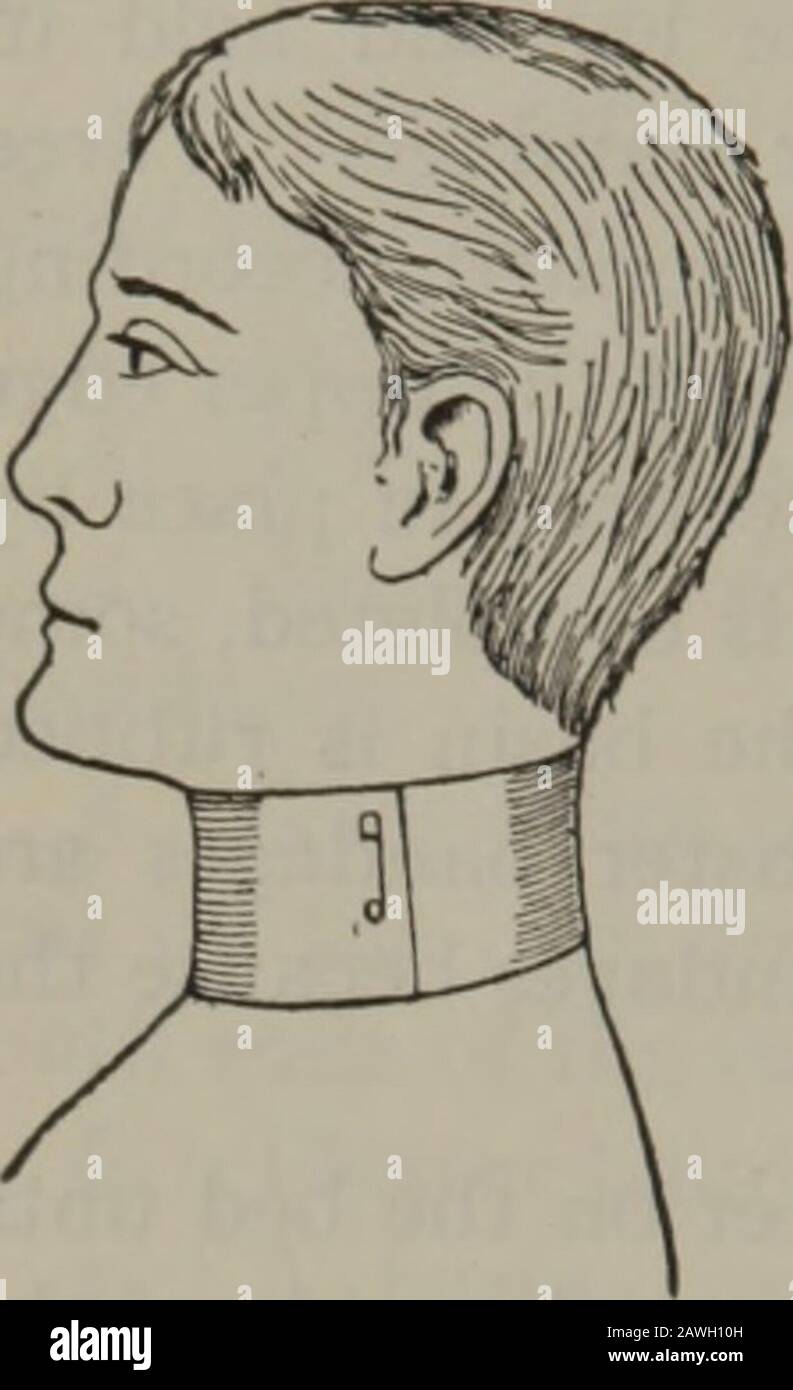 Soins infirmiers pratiques : un livre de texte pour les infirmières . Fig.  7. Inversion De La Spirale Au-Dessus. Les bandages, les mappages et Les  Attelles 465 font de la traction sur