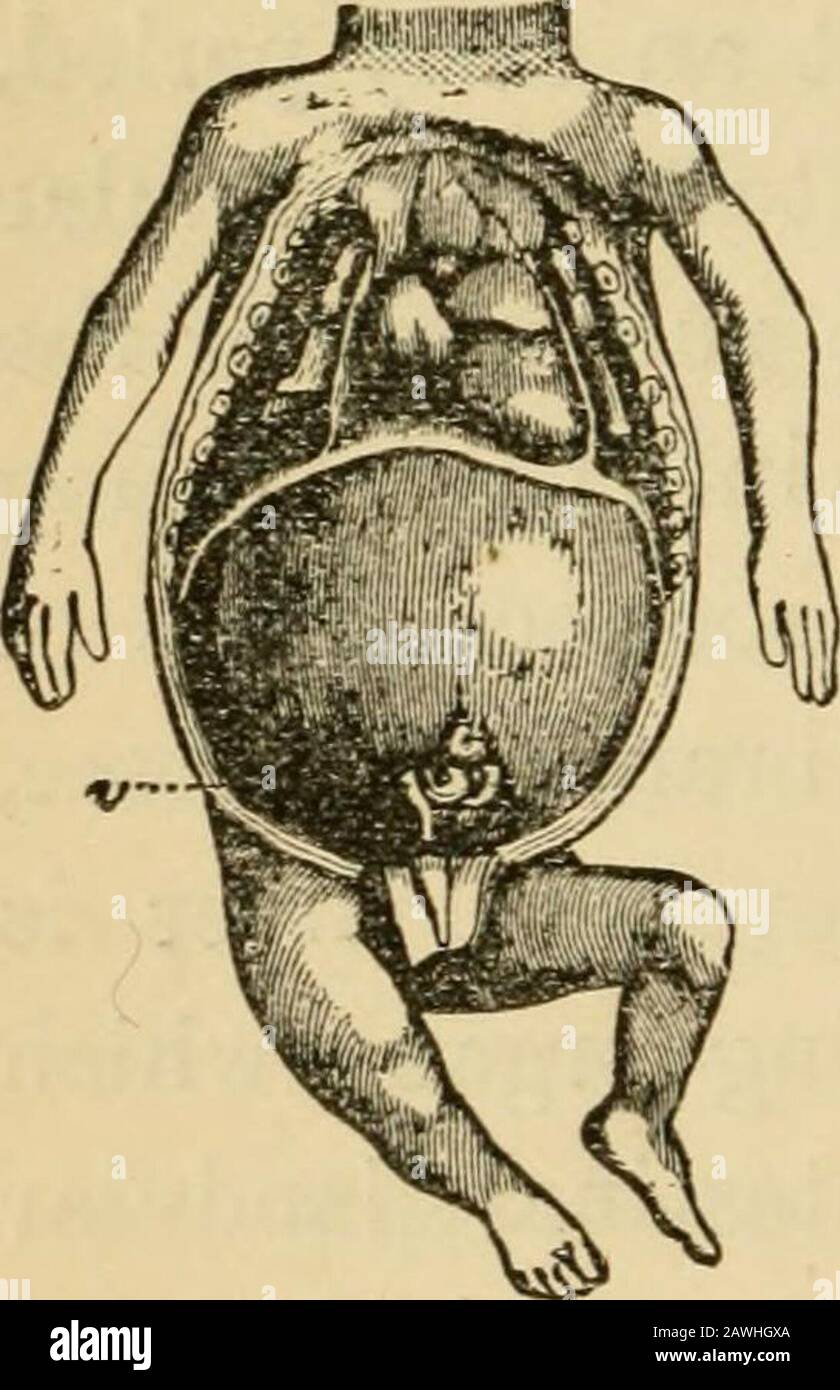 L'évolution de l'homme : une exposition populaire des principaux points de l'ontogénie et de la phylogénie humain . grands vaisseaux sanguins qui traversent l'ensemble du foie, et les innombrables branches nettées dont sont interlacedavec le réseau des cellules du foie. Les vésicules biliaires, qui traversent l'ensemble du foie, collectent la bile et la déchargingit dans l'intestin, proviennent de passages intercellulaires le long de 342 L'ÉVOLUTION DE L'HOMME. L'axe des cordes cellulaires solides; ils se déchargent tous dans les gaines primitives de la vésicule biliaire principale ou biliaire, qui sont originateà partir de la base des deux protubérances originales de la théinte Banque D'Images
