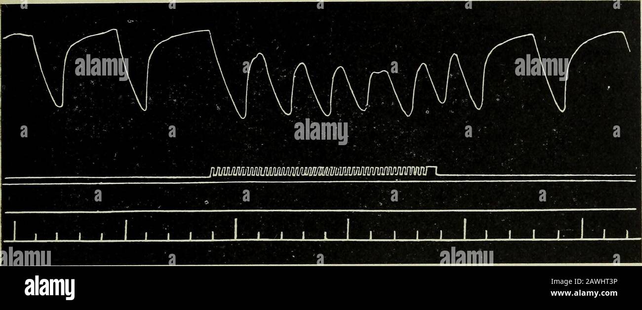 Pflügers Archiv für die gesamte Physiologie des Menschen und der Tiere .  Fig. 7. Vertel vom 25. Januar 1904. Ketten-strom. Dann Dauerreizung. Über  die Bedeutsch des Vagus für die Atmung. 67 Relais