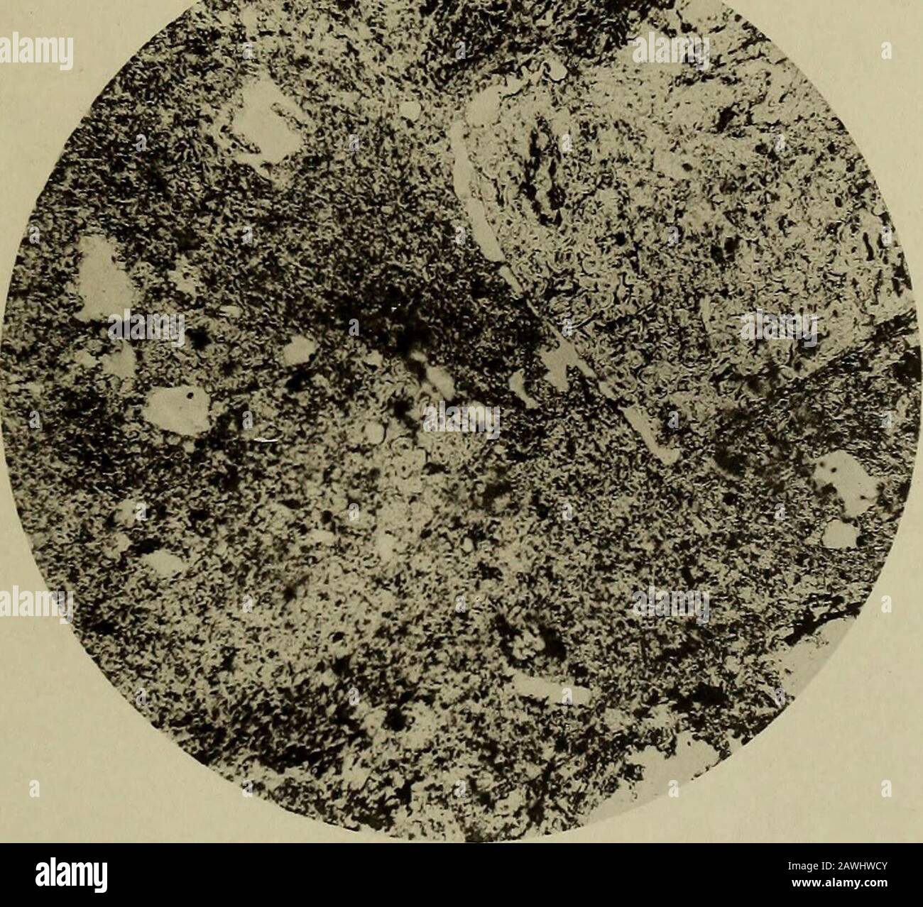 La revue trimestrielle de la Société géologique de Londres . Fig. 1. Fig. 2. Trachyte Phosphaté De L'Atoll De Clipperton. 54.] TEACHTTE PE031 ATOLL DE CLIPPERTON. 233 DiscTJSsiois (sur les deux Papes peeceding). M. Clowes a déclaré qu'en tant que chimiste, il se sentait nmch intéressé par M. Papier pour les salopettes. Il a supposé que l'auteur l'avait voulu comprendre qu'une double décomposition avait lieu entre la solution de theammonium-phosphate dérivée du guano et le silicate d'aluminium laqué insoluble de la roche ; dans ce cas, l'ammoniaumsilicate s'écarterait en solution, et aucun dépôt de wouldTake de silice Banque D'Images