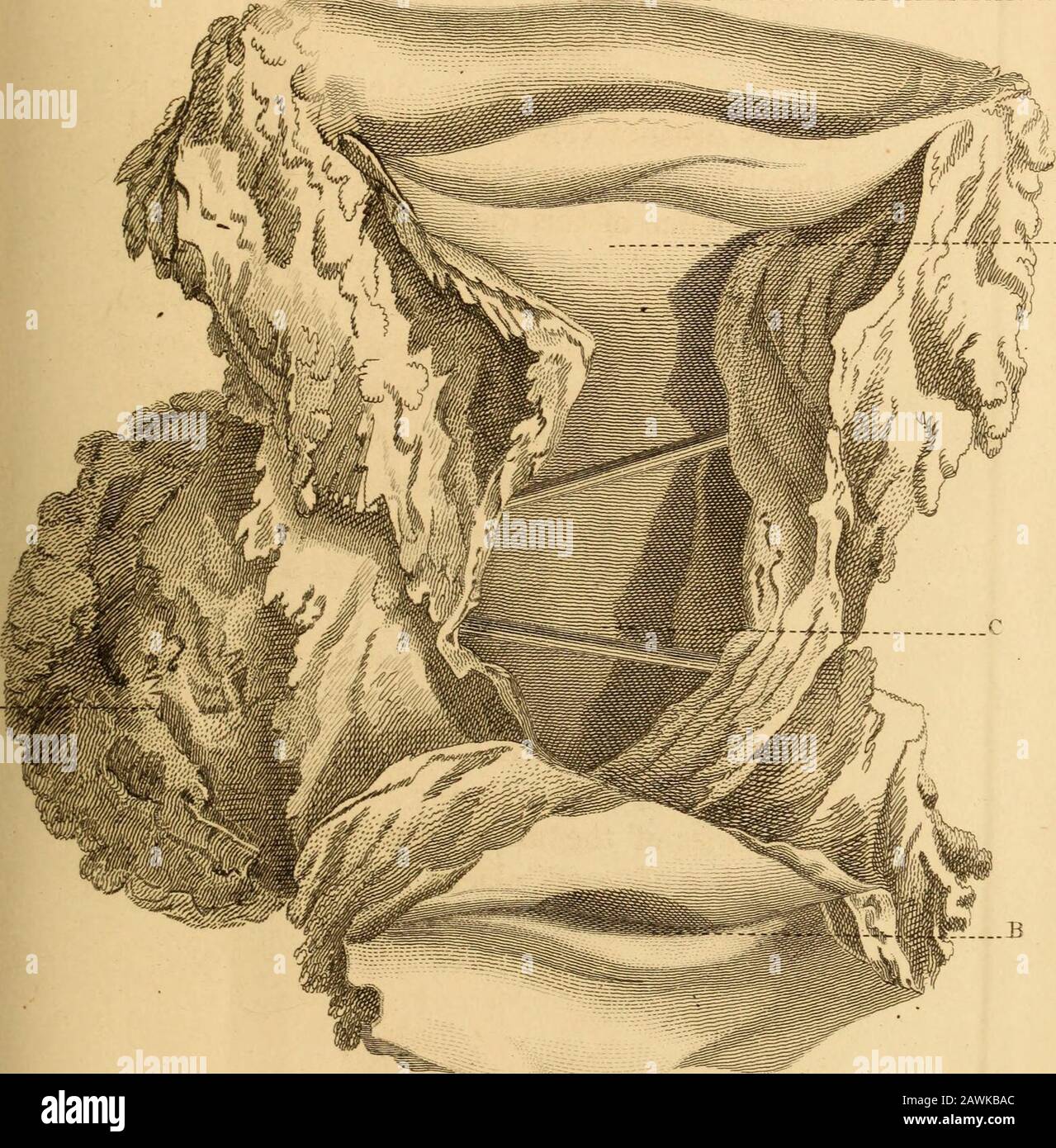 Observations sur les maladies des femmes qui sont assistées par dischargesillustrées par des plaques de cuivre des maladies, &c . dans une partie saine. B. une partie saine de l'intestin. C. la surface de coupe de la tu- mour carcinomateuse, dans laquelle peut être perçue somespots d'une couleur plus sombre: Ces derniers sont notoirement inhabituels dans de telles tumeurs. D. Une Autre surface de coupe, dans laquelle les lignes blanches décrites par le Dr Baillie sont veryévidentes. Z 2 340 EXPLICATION DES PLAQUES. PLAQUE VI Une vue très distincte du Carcinome Uteri, et des changements qui ont lieu dans cette viscusin conséquence de cette maladie. A. le carcinome Banque D'Images