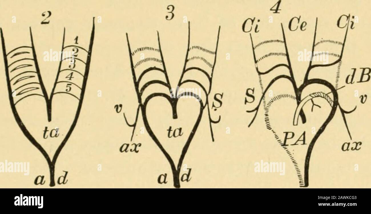 Un système d'obstétrique . Diagrammes pour illustrer le développement des Arches aortique (de Landois): 1, les trois premières paires d'arches, la première paire seulement entièrement développée; 2, les cinq paires d'arches aortiques; ta,bulbus artériosus; ad, aorte dorsale; 3, stade où la plus grande partie des première et des deuxième arches est devenue oblitérée ; S, artère sous-clavière gauche ; v, artère vertébrale droite ; AX, artère taxillaire droite ; 4, transition à l'étape finale ; P, artère pulmonaire ; A, aorte ; S, sous-clavière droite, continue avec la quatrième arche de ce côté et avec l'origine de la carotide com-mon; Ci et Banque D'Images