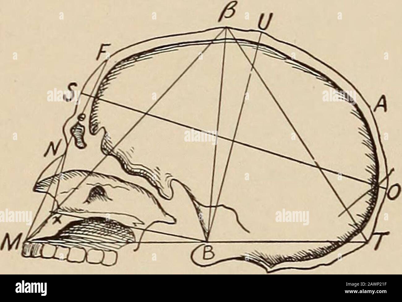 Maladies nerveuses et mentales . OFO B/NAUR/Cl/LAR-D/AM-Fig. 276. Fig. 277. Distance entre le basion et le sommet du crâne (Bto /? Ou U). Une ligne de la protubérance occipitale externe au point médian le plus faible du maxillaire supérieur, juste au-dessus des incisives [Tto M), passe presque directement par le basion. Par conséquent, en céphal-ométrie, en prenant ce diamètre et les rayons de chaque extrémité au bregma, nous avons un triangle (IT, /?, T) dont la hauteur (B, /?) est vérifiée. La hauteur moyenne est de 13,3 cm chez les hommes, 12,3 chez les femmes et la variation physiologique est de 11,5 à 1 Banque D'Images