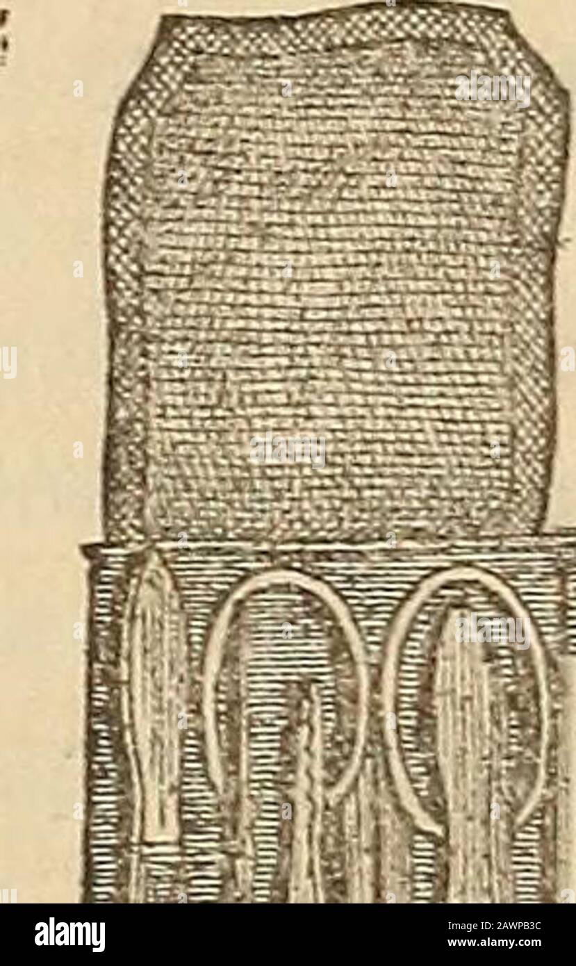 Le journaliste médical et chirurgical . ll la voie de la pronation complète à la supination complète. E. Il n'y a pas de gingymus latéral dans l'articulation de l'adultelbow. /. Le ginglymus latéral dans la pommade du coude du jeune modifiera l'attitude de l'avant-bras, tant avant que après la blessure. G, Les principes que je vous ai expliqués en ce qui concerne l'attitude de l'avant-bras sont la base d'un diagnostic rationnel et un traitement sain de la plupart des blessures de l'avant-bras. H. Mieux vous comprenez le mécanisme complexé de l'avant-bras, mieux vous pouvez le réparer quand il est endommagé. Communications. Un nouveau Banque D'Images