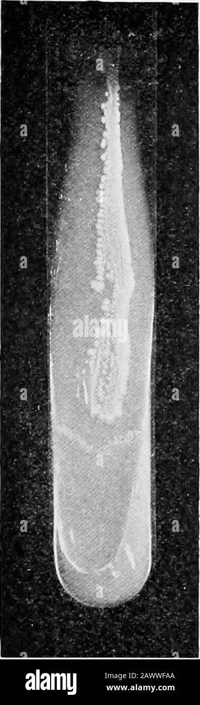 Les fondamentaux de la bactériologie ; être une introduction concise et systématique à l'étude des bactéries et des microörganismes alliés . (Fig. 54). Sur le hleod-coagulum (voir p. 72), la croissance est généralement grisante et les marges de la culture crénelée.Souvent, un diagnostic peut être fait en quatre heures si les tubes sériques sont conservés au four à 37° C. Dans le lait, l'abondance, sans ccurdling. Bouillon.—^Dans le bouillon, une croissance abondante a lieu, et ce milieu est utilisé pour obtenir les toxines. Coloration.—Est positive par Gramsmethod. Taché le mieux avec LoiSers al-kaline bleu de méthylène. Neissers doublement (voir p. 52) montre granu Banque D'Images
