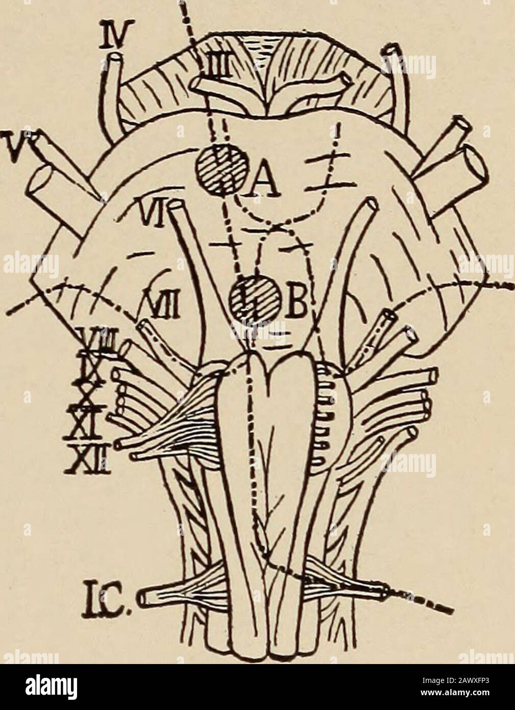 Maladies nerveuses et mentales . outh, corrélant les mouvements labiaux et linguistiques nécessaires à l'inphonation, à la mastication et à d'autres processus buccaux. La décapation du septième explique les phénomènes de paralysie alternée croisée du visage et des membres. Une lésion dans les pons au-dessus de la décusation implique à la fois le septième nerf et le pyramidaltractus pour le côté opposé du corps, mais au-dessous du passage facial au-dessus de la décapation pyramidale une lésion implique le visage sur le sameside et les membres du côté opposé. Une telle lésion doit être involutiondu tiers inférieur des pons, environ Banque D'Images Maladies nerveuses et mentales . outh, corrélant les mouvements labiaux et linguistiques nécessaires à l'inphonation, à la mastication et à d'autres processus buccaux. La décapation du septième explique les phénomènes de paralysie alternée croisée du visage et des membres. Une lésion dans les pons au-dessus de la décusation implique à la fois le septième nerf et le pyramidaltractus pour le côté opposé du corps, mais au-dessous du passage facial au-dessus de la décapation pyramidale une lésion implique le visage sur le sameside et les membres du côté opposé. Une telle lésion doit être involutiondu tiers inférieur des pons, environ Banque D'Images