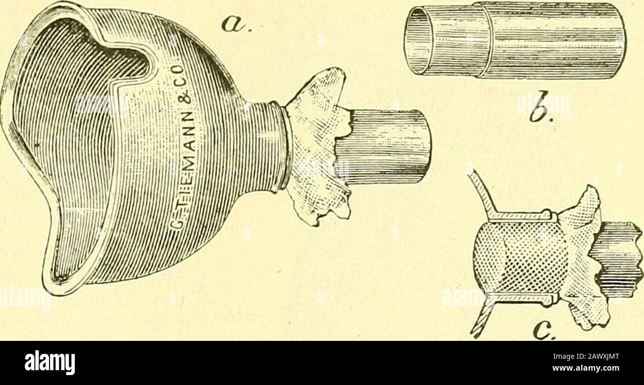 Narkologie : in 2 Bänden mit zahlreichen Abbildungen . 138. Apparat zur Athylnarkose vonErdmann-Tiemann.A Exspirationsventil. B Skala mit Hahn zumDosieren des Gasgemisches. C Ventil zumLuftzutritt. DAS Aethylchlorid wid in dieKammer, an welcher der Hahn und die SkalaB angebracht sind, vorher gegossen. 467 mittels einer Drahthaube, wie sie in C dieser Abbildung angedeutet ist, etwasMill und steckt das Rohr B mit dem Mull und der Drahthaube armiert in: A ein. Alors, c'est le Point D'Accès Banque D'Images