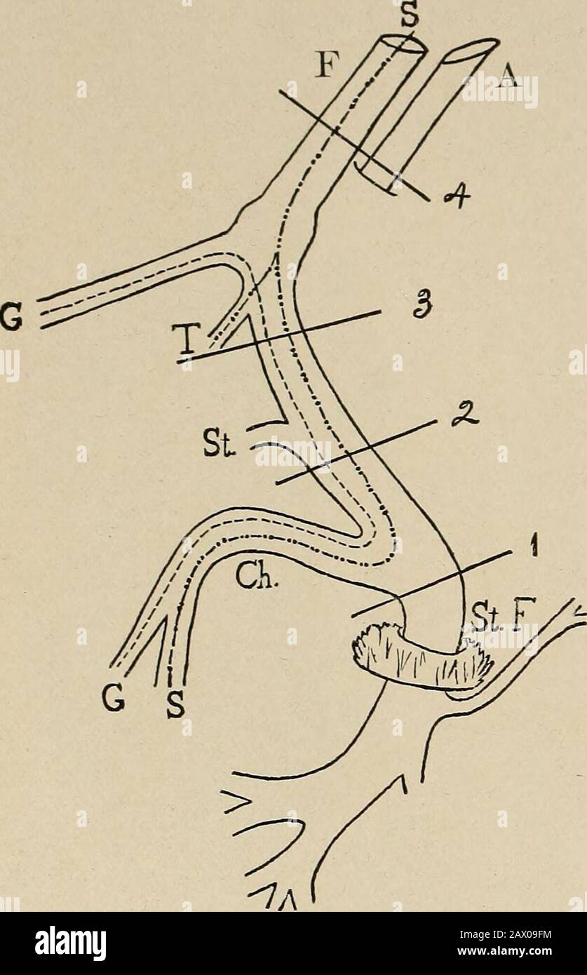 Maladies nerveuses et mentales . tion de l'occi-pitotrontalis. Le tronc dans la substance de la parotidthen se divise en (4) branches widelypropagées supplyingmotion à tous les muscles du visage, au platysma, au stylohyoïde, et le ventre postérieur du thédigastrique. Pratiquement, le septième nerf peut être considéré comme un mouvement pur.Il fournit l'approvisionnement trophique aux muscles du visage. Les filaments sensoriels et sécrétoires se rejoignent tout simplement pendant son parcours et partent avant qu'ils n'atteignent sa périphérie. Lorsqu'il est malade, les principales symp-toms sont des moteurs et consistent en des acti augmentés ou diminués Banque D'Images Maladies nerveuses et mentales . tion de l'occi-pitotrontalis. Le tronc dans la substance de la parotidthen se divise en (4) branches widelypropagées supplyingmotion à tous les muscles du visage, au platysma, au stylohyoïde, et le ventre postérieur du thédigastrique. Pratiquement, le septième nerf peut être considéré comme un mouvement pur.Il fournit l'approvisionnement trophique aux muscles du visage. Les filaments sensoriels et sécrétoires se rejoignent tout simplement pendant son parcours et partent avant qu'ils n'atteignent sa périphérie. Lorsqu'il est malade, les principales symp-toms sont des moteurs et consistent en des acti augmentés ou diminués Banque D'Images