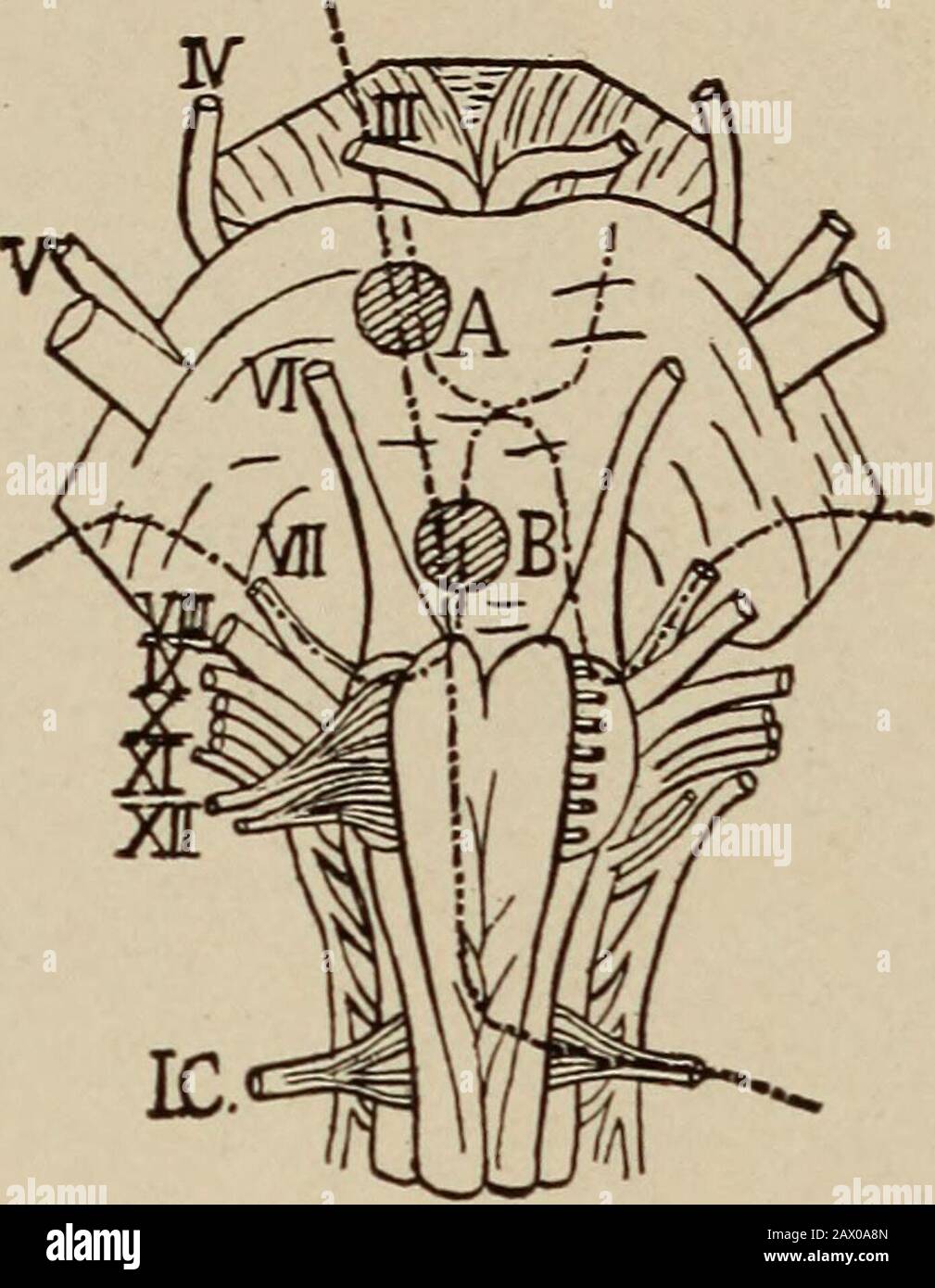 Les maladies nerveuses et mentales . du septième, et sont finalement distribuées au muscle orbiculaire du themouth, corrélant les mouvements labiaux et linguaux nécessaires l'inphonation, la mastication, et d'autres processus buccaux. La décapation du septième explique les phénomènes de paralysie alternée croisée du visage et des membres. Une lésion dans les pons au-dessus de la décusation implique à la fois le septième nerf et le pyramidaltractus pour le côté opposé du corps, mais au-dessous du passage facial au-dessus de la décapation pyramidale une lésion implique le visage sur le sameside et les membres sur l'oppo Banque D'Images Les maladies nerveuses et mentales . du septième, et sont finalement distribuées au muscle orbiculaire du themouth, corrélant les mouvements labiaux et linguaux nécessaires l'inphonation, la mastication, et d'autres processus buccaux. La décapation du septième explique les phénomènes de paralysie alternée croisée du visage et des membres. Une lésion dans les pons au-dessus de la décusation implique à la fois le septième nerf et le pyramidaltractus pour le côté opposé du corps, mais au-dessous du passage facial au-dessus de la décapation pyramidale une lésion implique le visage sur le sameside et les membres sur l'oppo Banque D'Images