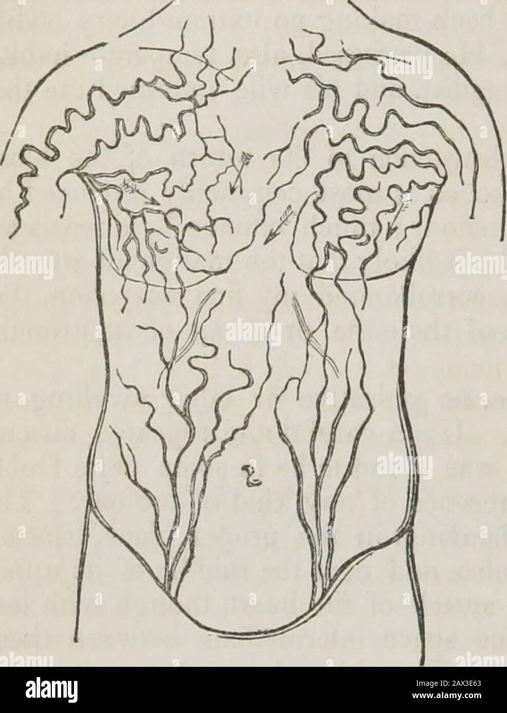 Conférences sur les principes et la pratique de la physique : données au King's College, Londres . ur attention à l'état des theveins. Les deux grands troncs qui, de part et d'autre, s'unissent pour former le supérieur de venacava, ont été complètement fermés, ainsi que la partie correspondante de *He 3k2 714 MALADIES DES VEINES. Cava elle-même, qui a été perdue et confondue dans les murs du sac anévrismal de tne. _ les veines de Thesubclavian étaient pervious jusqu'au point où ils ont rejoint les jugu-lars internes, mais pas plus. La préparation de ces parties, qui est devant vous, et therough diagrammes que j'exh ici Banque D'Images