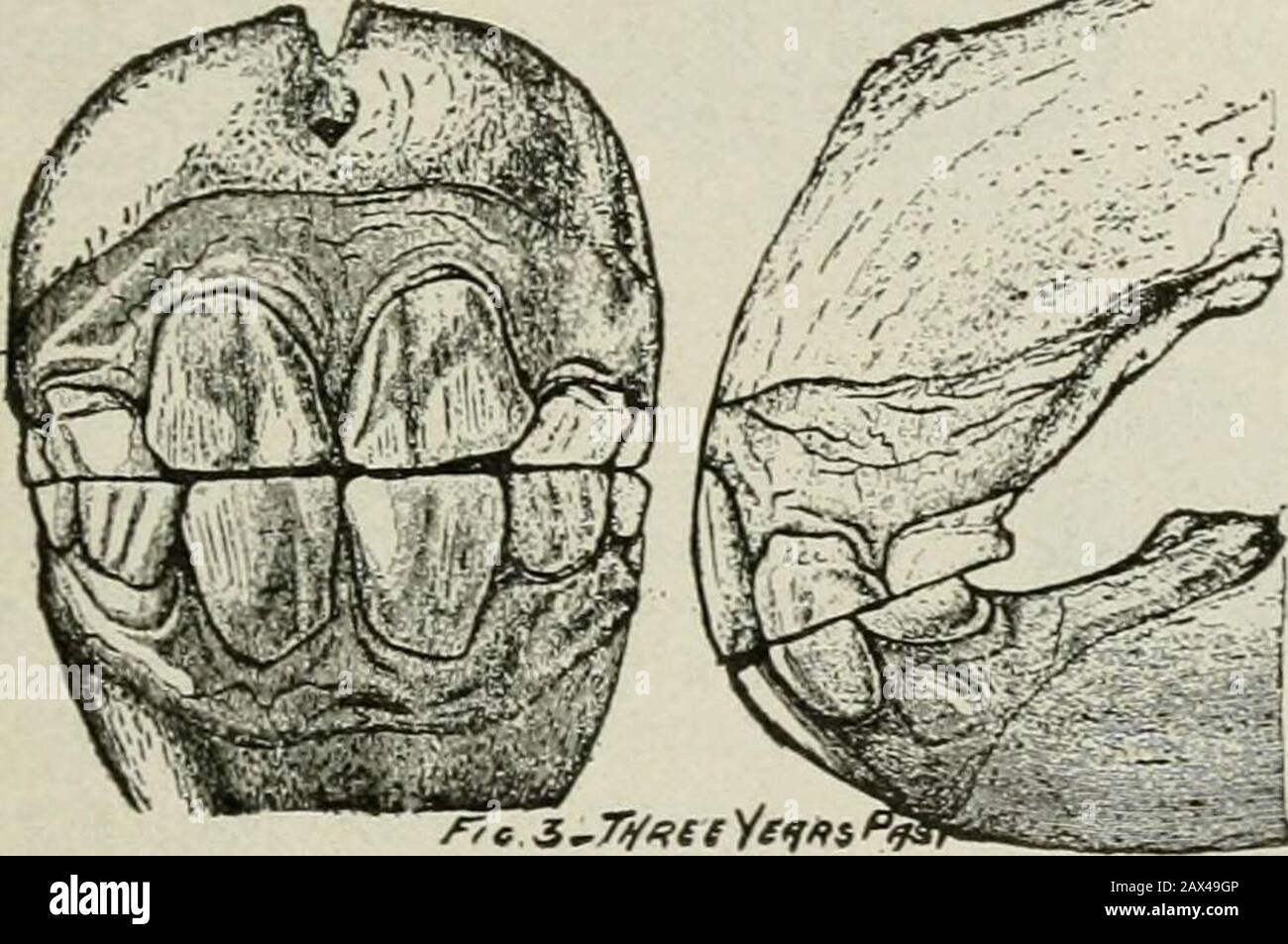 Agriculture réussie : une référence prête à toutes les phases de l'agriculture pour les agriculteurs des États-Unis et du Canada . Fig. 1.—À l'âge d'un an, la mâchoire est étroite, la téethare temporaire est petite et les incisives d'angle sont encore en contact. Fig. 2.—À deux ans de vie, la mâchoire montre une plus grande veuthque à un an, et le théeteeth sont tous en contact et en montre une usure considérable. Banque D'Images