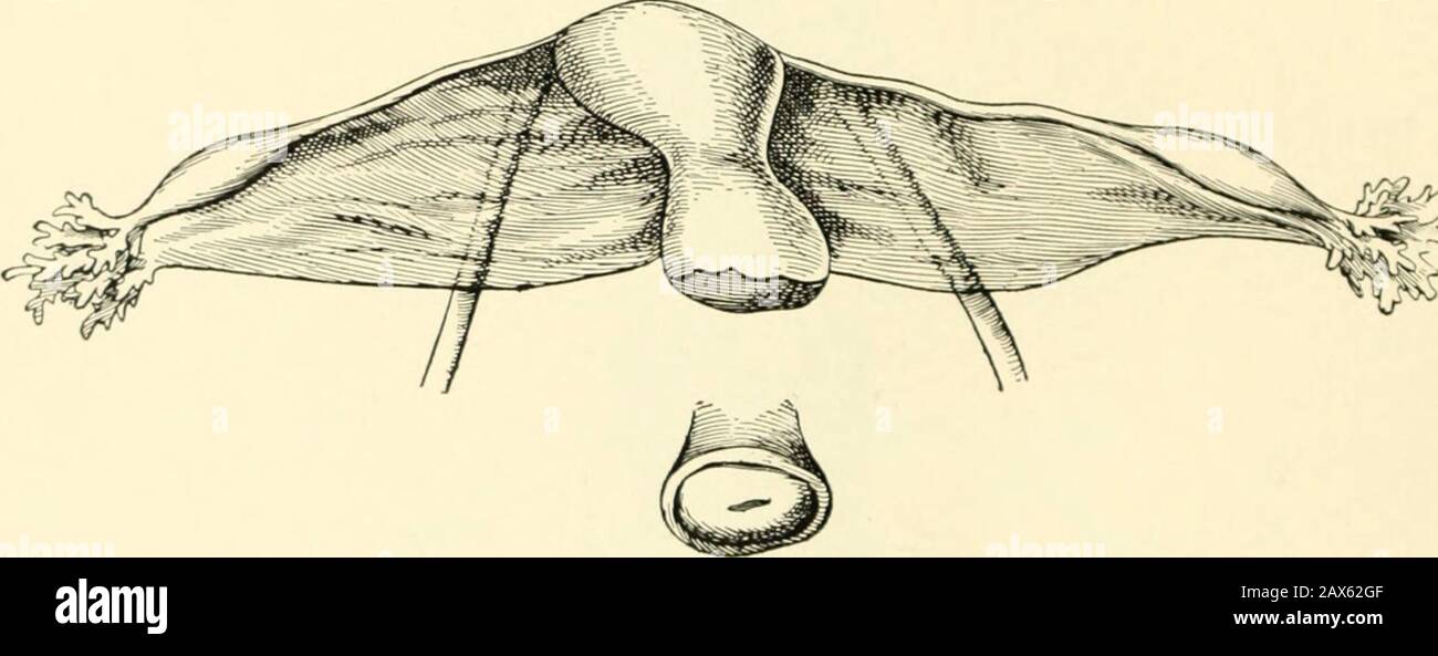 Un manuel d'obstétrique . Fig. 46.—utérus monocornis Mal développé: A, col de l'utérus; 6, fundus; &lt;, d, longitudinal du corps utérin; e, cornu; /, tube; g, ovaire; k, ligament ovarien; 1, ligament rond; £, parovarium. Oeuf K»?. Fig. 47.—mauvais développement du côté droit de l'utérus ; flexion latérale congénitale. Banque D'Images