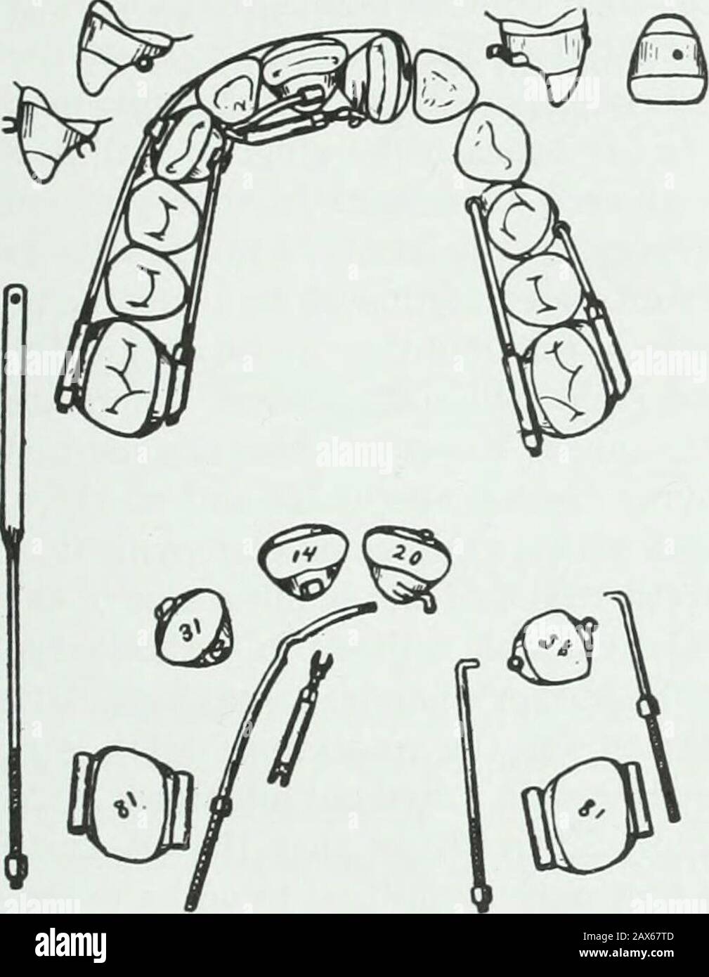Un traité pratique sur les techniques et les principes de l'orthopée dentaire et de la correction prothétique du palais de fente . CHAPITRE XLVIII. Malt URN ED DENTS 341 Dans presque tous les cas qui nécessitent une rotation étendue, et qui ne nécessitent pas de mouvement de réincarnation, il sera trouvé par une petite étude que la forcescan réciproque sous une forme quelconque sera appliquée. Une mauvaise position non rare est celle d'un centralincisor tourné d'un quart autour et verrouillé dans cette position par des dents adjacentes, comme illustré sur la Fig. 242. Un cric d'extrémité de fourche n° 19, reposant sur un crochet de branche lingual sur une incisive à effet de tête, exerce une force de rotation, TH Banque D'Images