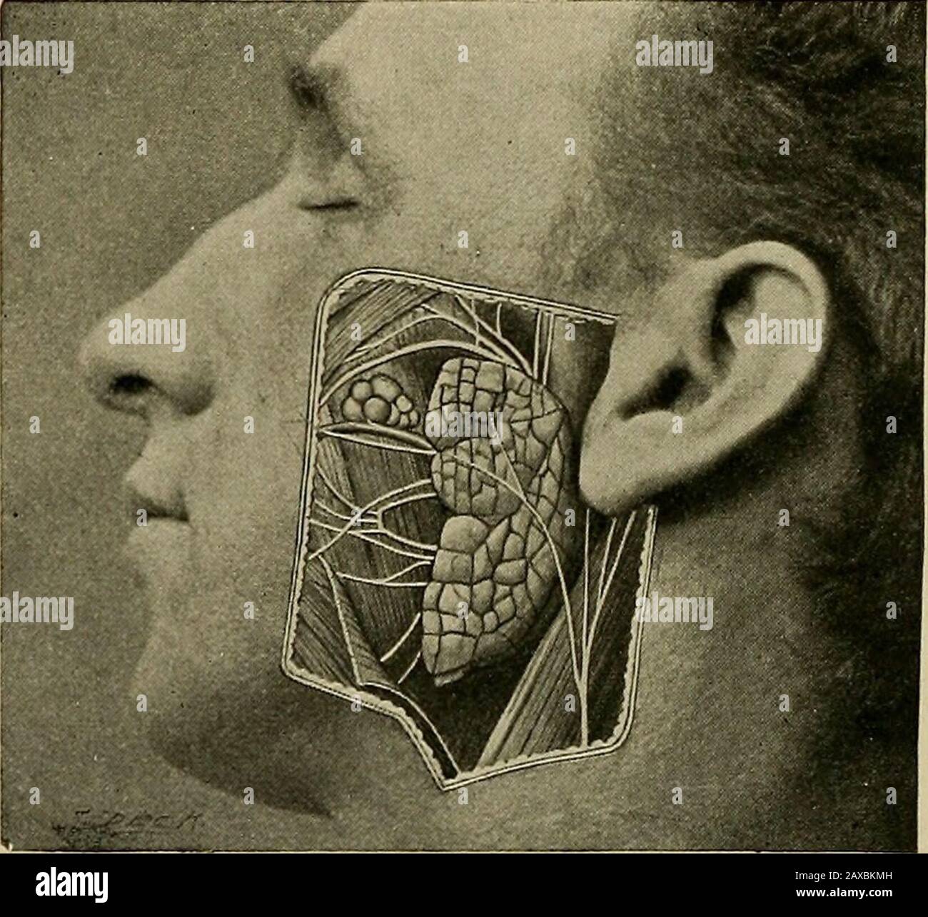 Anatomie appliquée et chirurgie orale pour les étudiants dentaires . minaof sortie du crâne. Donner les branches de la division ophtalmique du nerf trifacial. Donner les branches de la division maxillaire du nerf trifacial. Donner les branches de la division mandibulaire du nerf trifacial. Quelles sont les ganglions sympathiques qui sont reliés au cinquième nerf? Positions, racines et branches de Giveleurs. Quelles sont les fonctions du cinquième nerf? Ciboulez les origines profondes et superficielles du septième nerf. Donner le cours du septième nerf de son origine superficielle aux branches itsterminales. Donnez le blanc Banque D'Images Anatomie appliquée et chirurgie orale pour les étudiants dentaires . minaof sortie du crâne. Donner les branches de la division ophtalmique du nerf trifacial. Donner les branches de la division maxillaire du nerf trifacial. Donner les branches de la division mandibulaire du nerf trifacial. Quelles sont les ganglions sympathiques qui sont reliés au cinquième nerf? Positions, racines et branches de Giveleurs. Quelles sont les fonctions du cinquième nerf? Ciboulez les origines profondes et superficielles du septième nerf. Donner le cours du septième nerf de son origine superficielle aux branches itsterminales. Donnez le blanc Banque D'Images
