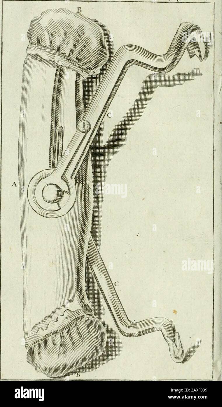 Le chrurgien dentiste, ou, droit des dents : où l'on enligne les moyens de l'entrêmir propres & saines, de les embellir, d'en réper la perte & de remédier à teurs maladies, à celles des gencives, & aux accidens qui peuvent les fêtes : avec des observations & dens flexions sur plusieurs cas singuliers : ouvrage enrichit de quarante-deux planches en taille douce . Tcni a l Linchc xc . ru.^ ? n o... Dentier Lo^ D. la partie de cette plaque qui ap-puie fur la couronne des dents qui lacompriment. EE. Les joues de cette plaque quiembrafTent lapareil. Banque D'Images