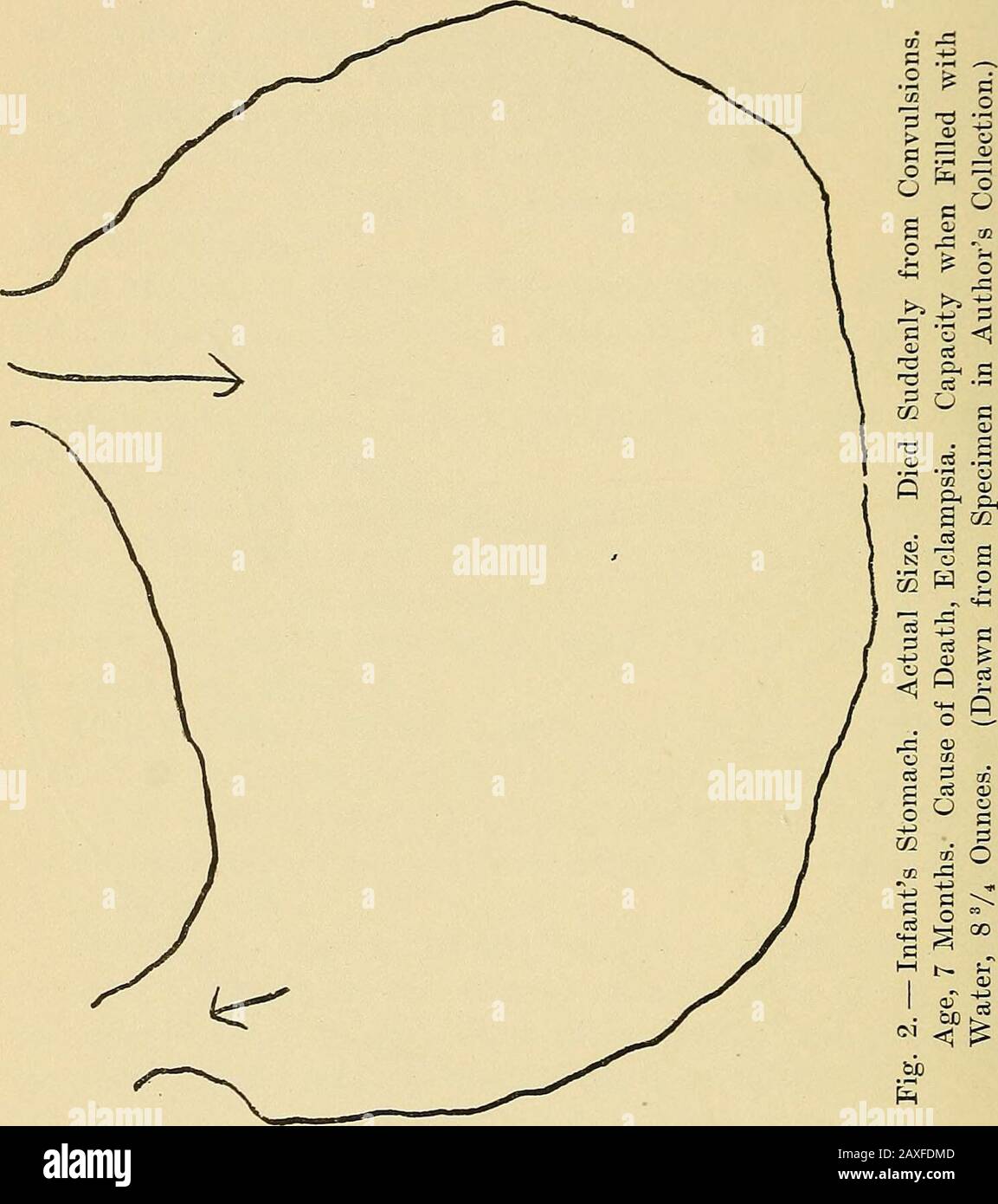 L Alimentation Des Nourrissons Dans Son Rapport A La Sante Et A La Maladie Par Louis Fischer Contenant 54 Illustrations Avec 24 Graphiques Et Tableaux Principalement Originaux Diately Apres Soins Infirmiers Pour L Alimentation Des Nourrissons Dans Son Rapport A La Sante Et A La Maladie Par Louis Fischer Contenant 54 Illustrations Avec 24 Graphiques Et Tableaux Principalement Originaux Diately Apres Soins Infirmiers Pour