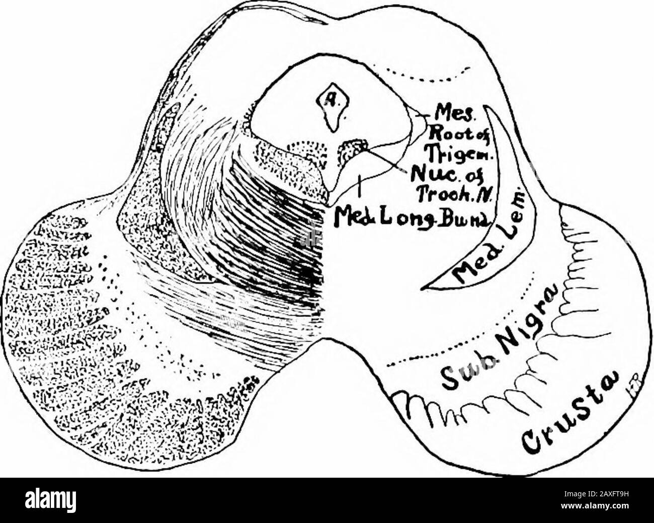 Un manuel d'anatomie . s précédemment mentionné se compose des fibres cochléaires ventrales et des cellules nerveuses comprenant le noyau de L'ANATOMIE INTERNE DU CERVEAU MÉDIAN 405 le lemniscus latéral, Apparemment une continuation cf l'olive supérieure.Ici certaines des fibres de l'extrémité du lemniscus et de nouvelles sont issues des cellules du noyau et continuent, à la fin dans le corps inférieur de quadriculate de quadriculine et peut-être dans le supérieur quadrigeminum. La zone médiane dorsale du formatio reticularisis occupé par le fascicule longitudinal tnédien. Dorsal à cet aréais le su gris ventriculaire Banque D'Images