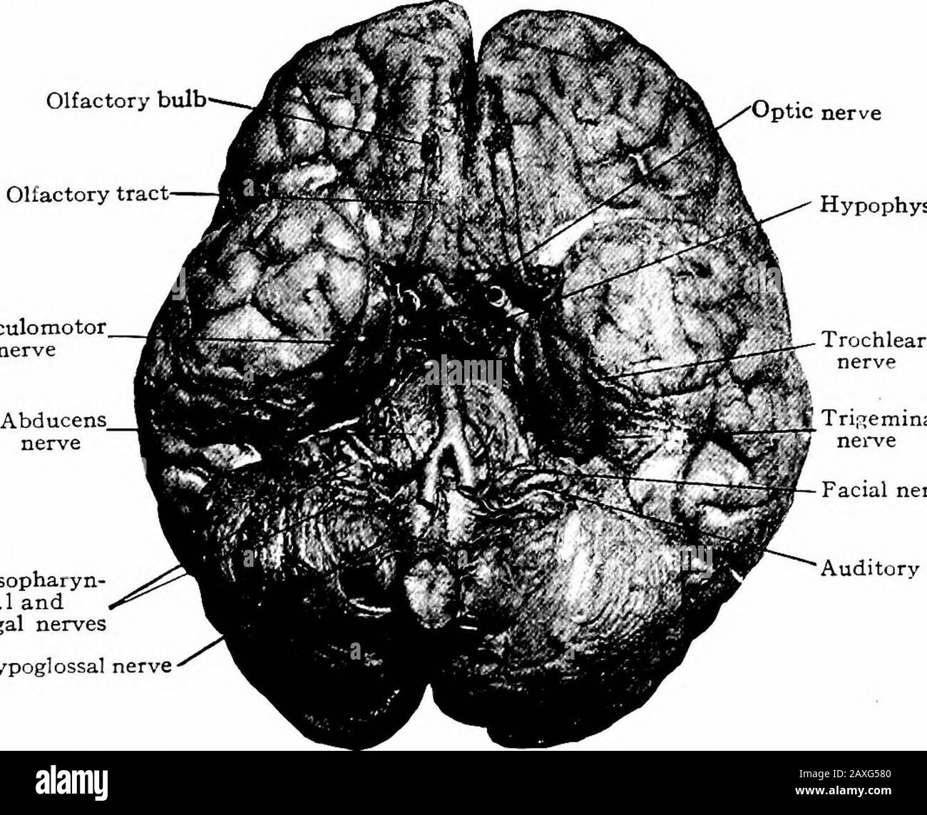 Un manuel d'anatomie . ou de préhypophyse,et une partie postérieure, la post-hypophyse. Le premier est la structure de l'épithélialine et est dérivé de l'épithème oral; le posthypophy-sis est un dérivé direct du système nerveux. Ces deux parties sont reliées ensemble par une capsule commune. Le chiasme optique se trouve juste devant le tubercule et est formé par 384 LE SYSTÈME NERVEUX la convergence des nerfs optiques ici, assisté par une decussationde certaines de leurs fibres. Les fibres nerveuses de la partie nasale de chaque rétine traversent le côté opposé du cerveau alors que celles du côté temporel de la rétine Banque D'Images