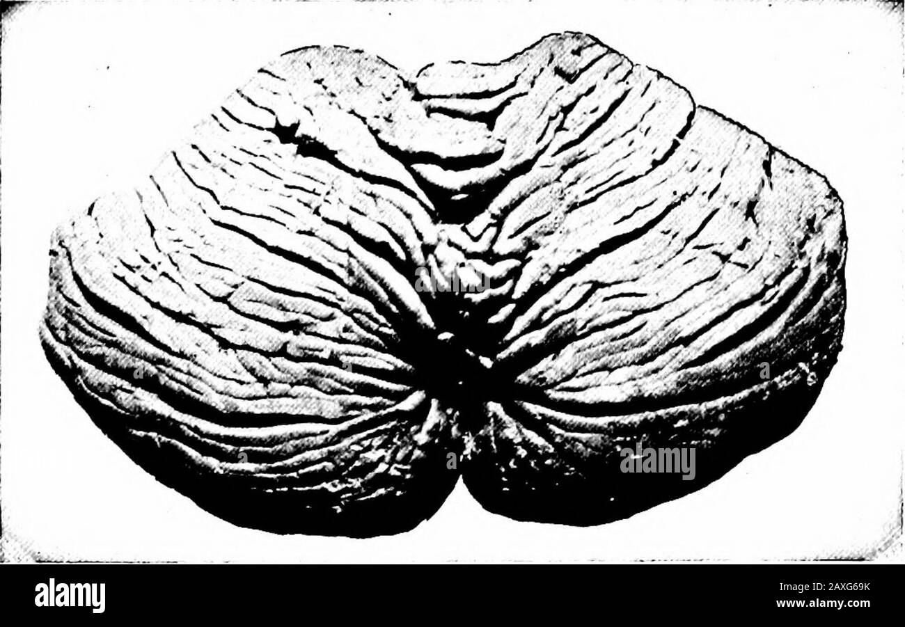 Un manuel d'anatomie . noyaux de dentat intacts. (À partir d'une photo.) LE CERVELET Le cervelet se trouve dans la fosse postérieure du crâne sous le couvert du pôle occipital du cervelet dont il est séparé par le rayon de la dura appelé tentorium cerebelli. Il atteint en moyenne 165 grammes chez le mâle et 155 grammes chez la femelle, atteignant son grandeur entre les vingt-cinquième et trente-cinquième années. Il réorganise un centre de coordination et pourrait bien être appelé le balancingbrain. Le cervelet se compose de deux lobes latéraux, ou hémisphères, du lobe moyen de l'anda ou du vermis. Les deux hémisphères sont Banque D'Images