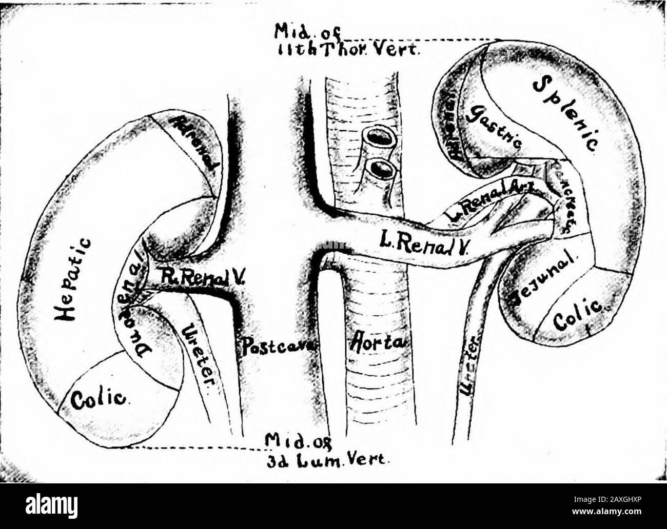 Un manuel d'anatomie . rior pancréaticoduodenale (de la gastroduodenale de l'artère hépatique), le pancréaticoduo-denale inférieur (de l'artère mésentérique supérieure) et les branchespancréatiques des artères splénique et hépatique. Les veines vides dans les veines mésentériques, spléniques et portiques supérieures. Les nerfs sont mainlysympathiques du plexus solaire par le biais des plexus mésentérique supérieur et splénique cœliques. Chapitre VIII L'APPAREIL URINAIRE l'appareil urinaire comprend les deux reins, deux uretères, le ditheMadder et l'urètre. Le KJDITEYS Chaque rein {ren) est un grand organe en forme de haricot, Banque D'Images