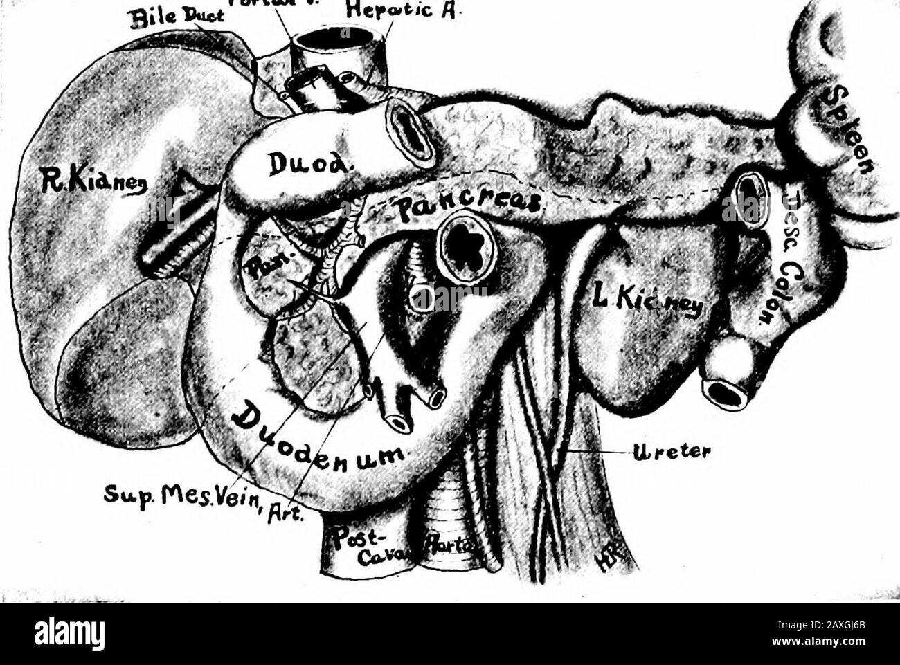 Un manuel d'anatomie . iJ4 à IH pouces (3 à 3,75 cm.) de longueur et 314 LE TUBE DIGESTIF de 3 à 4 mm de diamètre. Il rejoint le canal hépatique pour former le canal biliaire com-mon. Le canal biliaire commun {ductus chidochus) est d'environ 3 J^ à 4 pouces (8,5 à 10 cm.) de longueur, de 6 à 7 mm. De diamètre et passe dans la paroi duodénale où il rejoint le canal pancréatique. Ces conduits passobhquely à travers les couches du duodénum et avant l'ouverture dans la lumière de cet organe il y a une dilatation de ce combinedduit appelé l'ampulla de Vater. L'orifice du conduit commun est de 3H à 4 pouces du pylor Banque D'Images