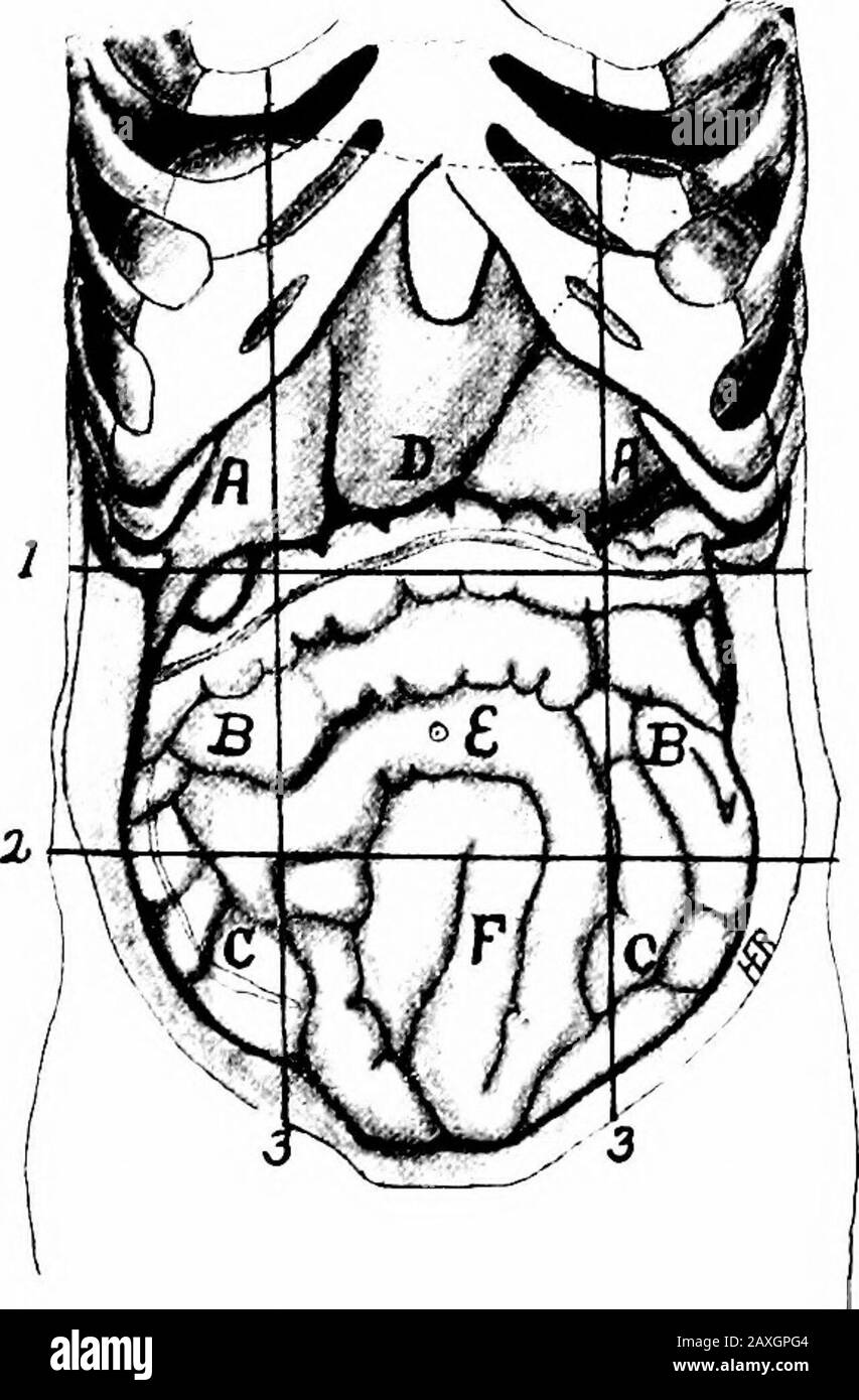 Un manuel d'anatomie . t plus grand et le coccyxplus mobile, l'archplus pubienne et moins angulaire. Les ouvertures des abdominalmuls sont les trois ouvertures dans le diaphragme, les ouvertures dans le plancher pelvien pour le rectum theurètre et dans la femelle thevagina; le canal inguinal pour le cordon thespermatique chez le mâle, Ou ligament theround chez la femme, et le canal crural ou fémoral débouche dans la cuisse. L'abdomen est divisé régions d'intonine par quatre lignes ou plans, deux horizontales et deux verticales.UNE ligne tracée sur le tronc à la limite inférieure du cartilage tenthal costal et la p supérieure Banque D'Images