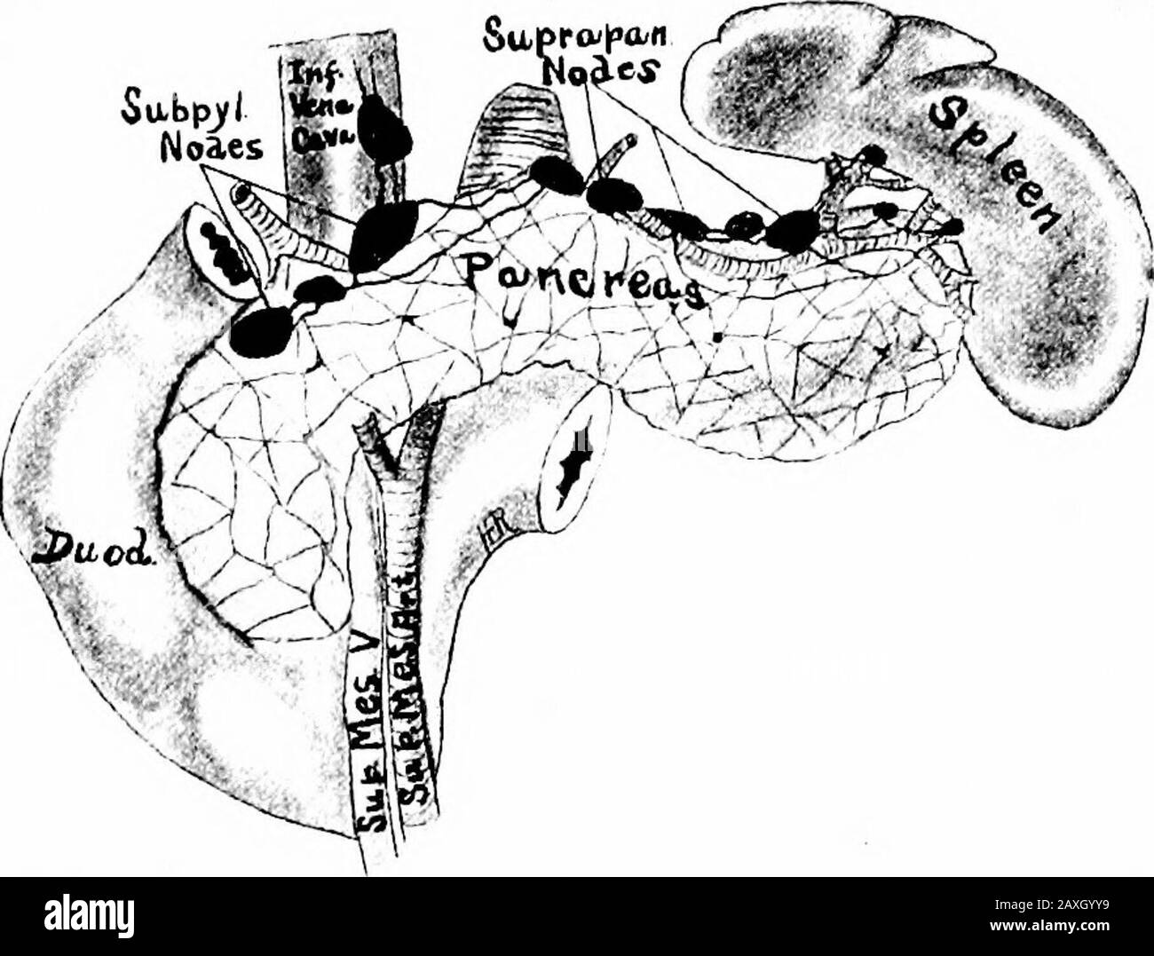 Un manuel d'anatomie . partie de l'iléon, du cecum, de l'appendice et du côlon ascendant et vider la lymphe dans les mésentéricnodes supérieurs. (C) les nœuds mésocoliques (faisant partie de la chaîne paracolique) sont des chiffres et il est en relation avec le côlon transverse. La lymphe du système VASCULAIRE LYMPHATIQUE 264 traverse le côlon à travers ces nœuds et la thence jusqu'aux nœuds mésentériques supérieures. Du groupe mésentérique supérieur la lymphe est drainée par le tronc mésentérique supérieur qui aide à former le tronc intestinal commun. 3. Le groupe mésentérique inférieur hes à l'origine de l'artère inferormesentérique. Banque D'Images