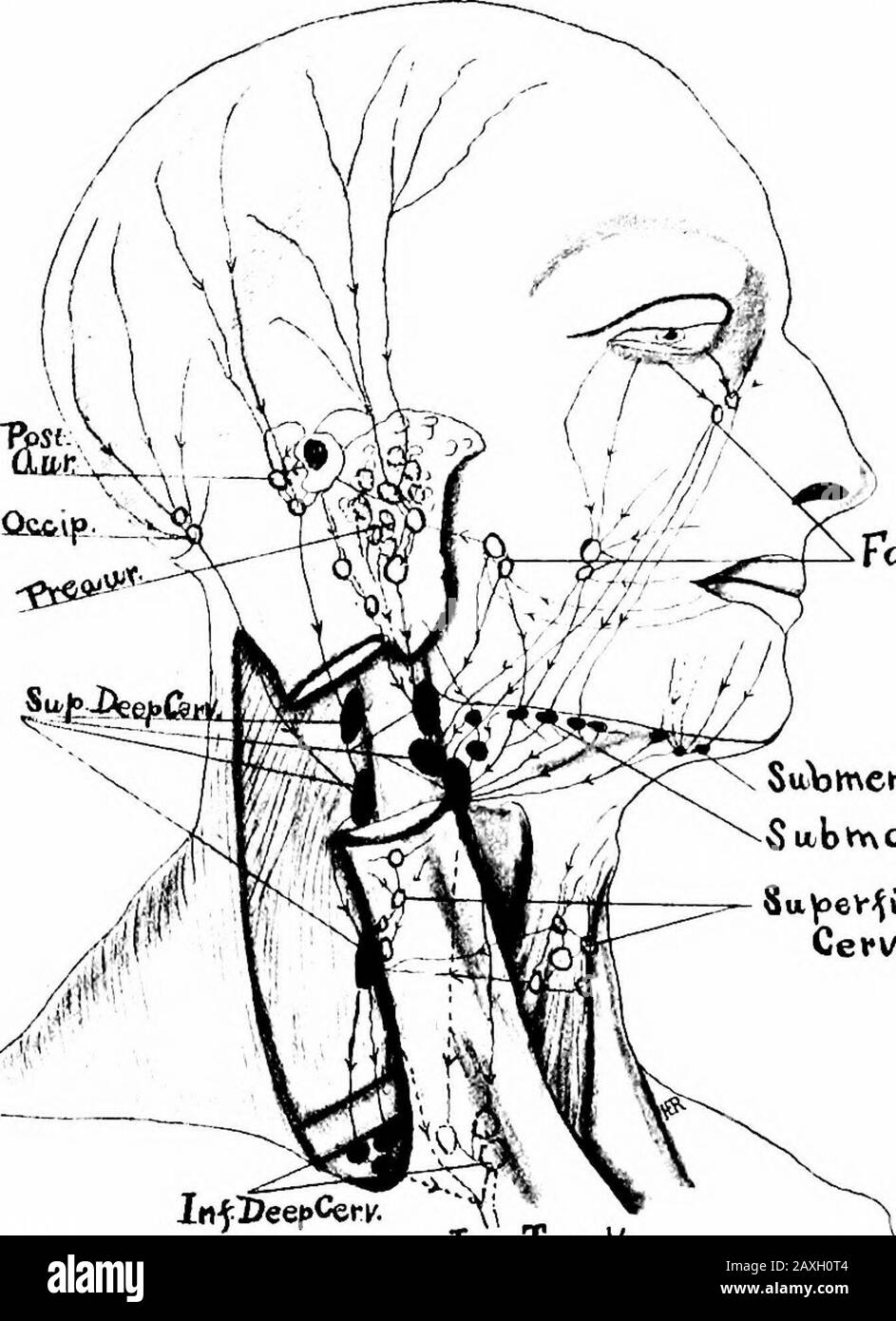 Un manuel d'anatomie . Su)menta/l In-jDeepCei-c. X   Fig. 187.—ganglions Lymphatiques et drainage lymphatique de la tête et du cou, indiqués comme cercles et nœuds profonds en noir solide. Nodeh superficiel dans la région de l'infraorbitale; {b) le groupe buccal ou buccinateur dans le thecheek; (c) le groupe supramandibulaire sur la mandibule au bord antérieur du muscle masseur. Ces groupes drainent le couvercle oculaire, la conjonctive, la peau et les muqueuses du nez et de la joue. Leurs efférateurs portent la lymphe aux nœuds submaxillaires et aux nœuds cervicaux profonds supérieurs. 5. Visage profond (L. faciales profimdce) (D).—Ce groupe Banque D'Images