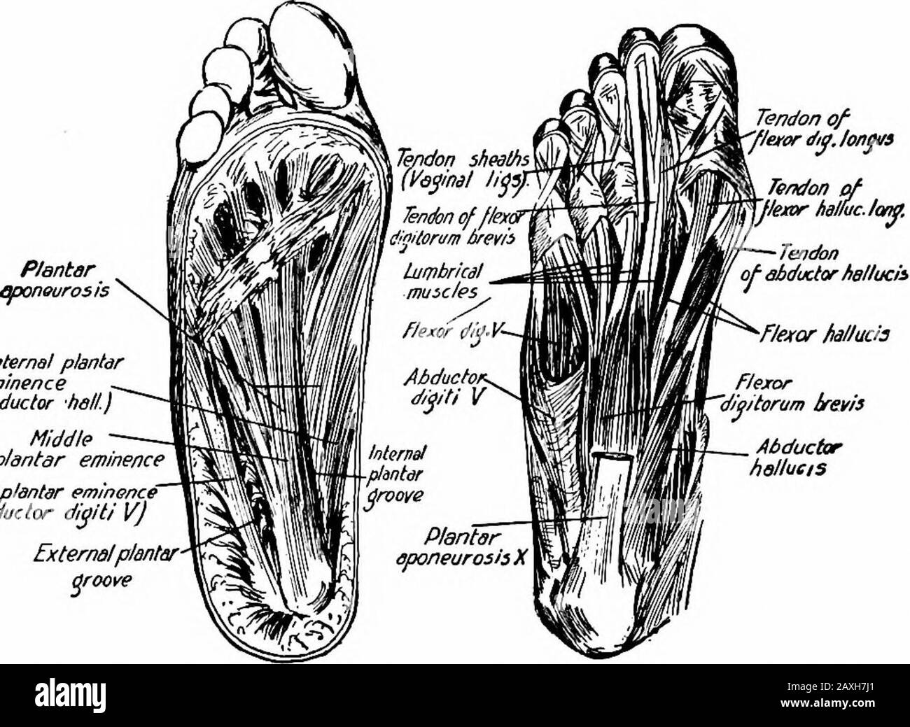 Un manuel d'anatomie . dans la surface latérale de la base du premier phalanx du petit orteil. Actions.—Fléchit et débouche le petit orteil. 2 o8 approvisionnement En Nerf MYOLOGY.—^nerf plantaire latéral (S. i, 2). Deuxième couche.—les mm. Lumbricales sont des muscles de Jour associés aux tendons de flexion et de digitorum longus. La première provient du côté thémadial du tendon pour le deuxième orteil et les autres proviennent du côté adjacent des quatre tendons. Chaque muscle est inséré dans le tendon extenseur et la base du premier phalanx des quatre orteils extérieurs, comme dans la main. Actions.—Flex le JO métatarsophalangial Banque D'Images