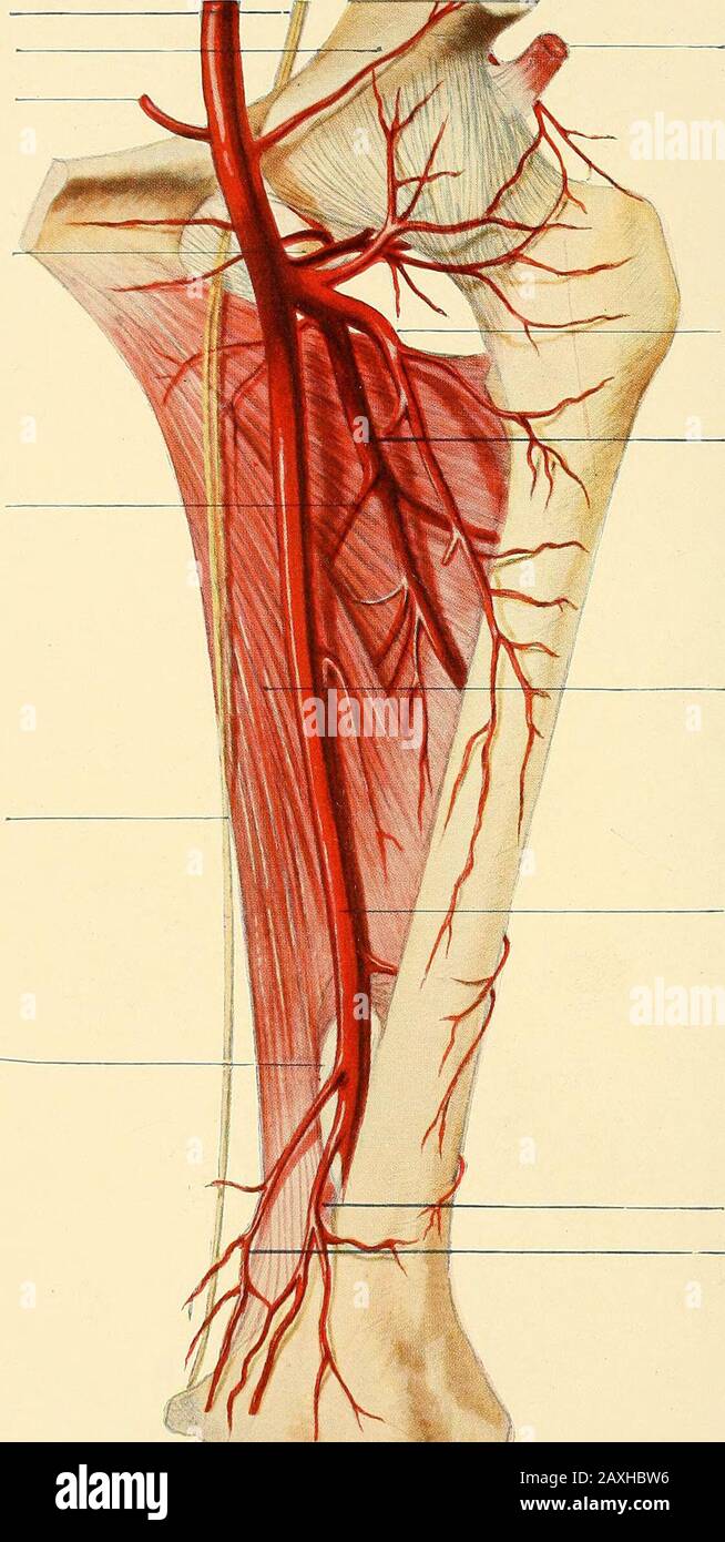 Un manuel de chirurgie opératoire . iin. Reversord TENDONOF RECTUS EXTERNAL CIRCUM-FLEX ARTERY DEEP FEMORALARTERY ADDUCTEUR MAGNUS ARTÈRE FÉMORALE  ANASTOMOTICAj ARTÈRE MAGNA ARTÈRES FÉMORALES, AVEC LEURS BRANCHES PRINCIPALES (page 410).(D'une dissection au London Hospital Museum.) UN MANUEL de O PER ATIVESGERY PAR SIR FREDERICK TREVES, Bart. G:C.V.O., C.B., LL.D., F.R.C.S. Serjeant-Surgeon à H.RI. Le roi, chirurgien ordinaire à H.R.H. le Princeof Wales, chirurgien-conseil à l'hôpital de Londres ET JONATHAN HUTCHINSON, F.R.C.S. Chirurgien et maître de conférences sur la chirurgie à l'hôpital de Londres, Exami Banque D'Images