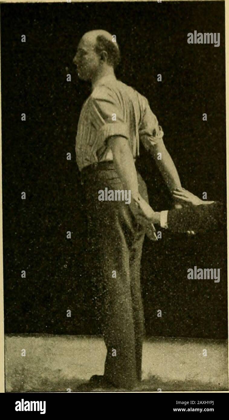 Maladies du coeur et du système artériel : conçu pour être une présentation pratique du sujet à l'usage des étudiants et des praticiens de la médecine . Fig. 95 Fig. 93. 460. Banque D'Images