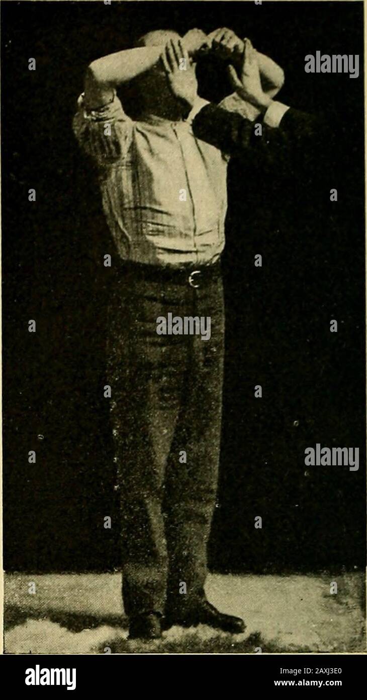 Maladies du coeur et du système artériel : conçu pour être une présentation pratique du sujet à l'usage des étudiants et des praticiens de la médecine . Fig. 87. Banque D'Images