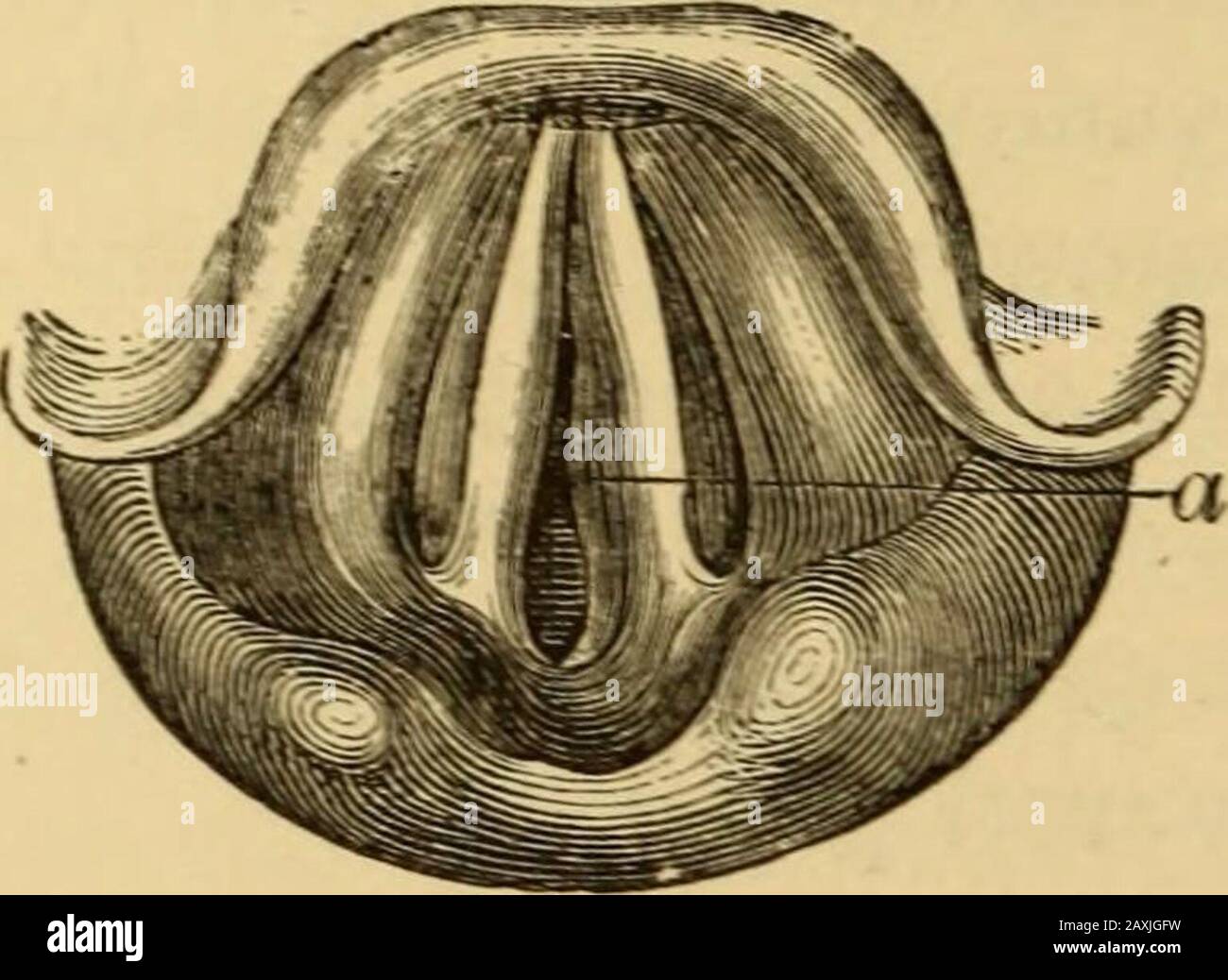 Maladies de la gorge et des passages nasaux; un guide pour le diagnostic et le traitement des affections du pharynx, des sophages, de la trachée, du larynx et des nares . processus étant similaire à ce occa-sioning lit-sores de pression sur des proéminences osseuses. Symptômes.—Les symptômes antérieurs ne sont pas caractéristiques.il Y a habituellement un peu de désarsénase avec la douleur locale, en particulier l'onmouvement ou la pression externe, et parfois en dégluti-tion ou en phonation. Enrouement, toux, et dysphagie se manifestaient plus tard ; puis dyspnée, peut-être avec stridor ou avec 1 Brit. Moyenne. Jour, 13 décembre 1873, p. 684. 52 S AFFECTIONS DE Banque D'Images