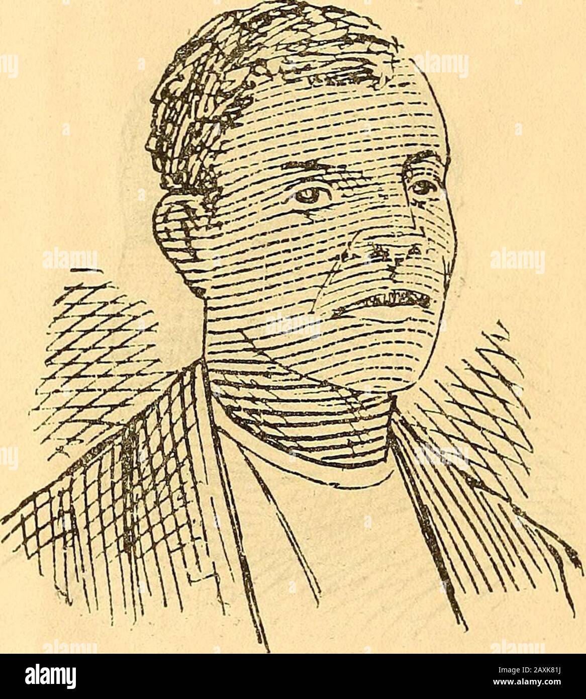 L'île de Navassa riot .. . ^CHARLES H. SMITH. Charles H. Smith, (alias John Ward), est né en 1858 et a été à Navassa cinq fois. 18. JAMES PHILIPS. James Philips est né à Greensboro et a 22 ans, Il était à Navassa environ huit mois. 19 Banque D'Images