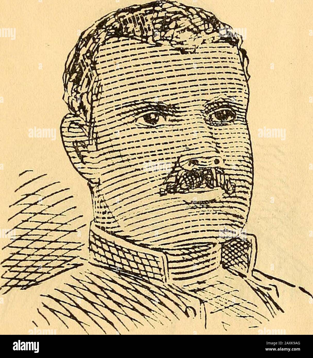 L'île de Navassa riot .. . *ALFRED JONES alias Texas Shorty. Alfred Jones, ou Texas Shorty, comme il est généralement appelé, est né à Philadelphie en 1864, ayant 25 ans, et dit qu'il est allé à Navassa en avril dernier. *Les Noms marqués d'un astérisque ont été réservés pour un compte plus complet de leur carrière. 17. ^CHARLES H. SMITH. Charles H. Smith, (alias John Ward), est né en 1858 et a été à Navassa cinq fois. 18 Banque D'Images