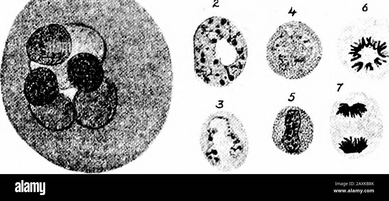 Un manuel d'anatomie . n systèmes sont absents. Cette varietyse se trouve dans les extrémités de la cavité de moelle osseuse des os longs, formol la majeure partie des extrémités de ces os et des os plats et courts et andirréguliers. Cette variété imparties la légèreté et permet d'augmenter la taille sans sacrifier la force. La médullaire, ou cavité de moelle, est longue, étroite et contient une flèche; elle se trouve dans les arbres des os longs. Il est doublé par 20 OSTÉOLOGIE l'endosteum qui sert de périoste interne et de couverture pour la moelle. Moelle osseuse.—Chez l'adulte, il existe deux variétés de moelle osseuse rouge Banque D'Images