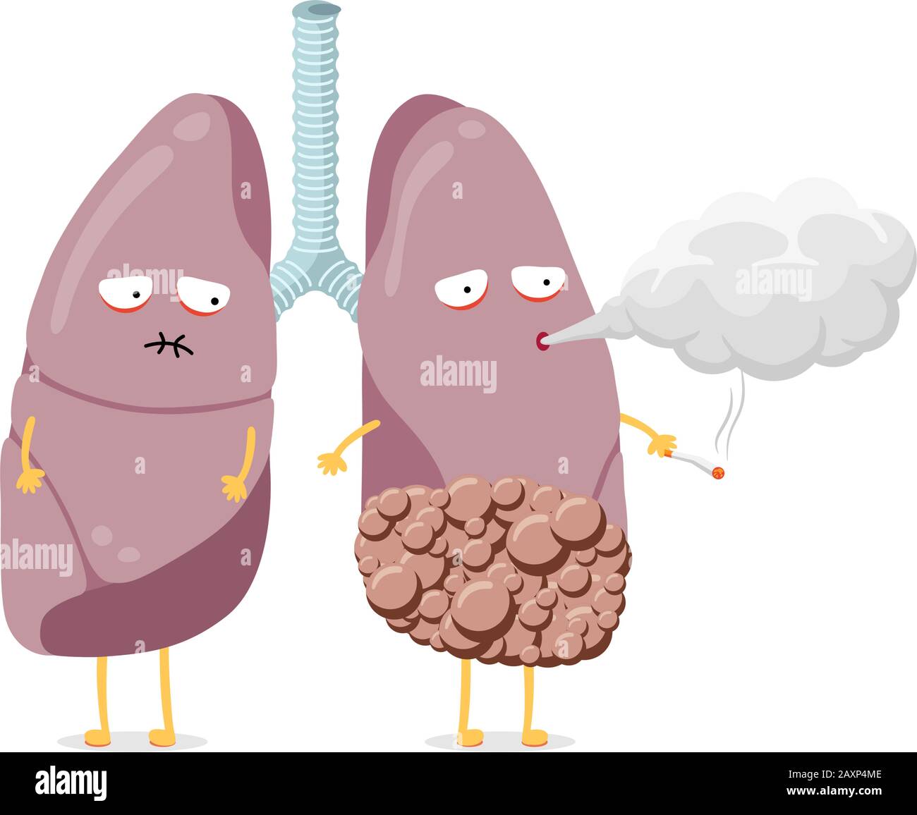 Mauvaise santé poumons caricature personnage fumer cigarette. L'organe interne du système respiratoire humain atteint d'un cancer souffle de la fumée et est en mauvaise santé. Mauvaise habitude dangereuse addiction vecteur eps illustration Illustration de Vecteur