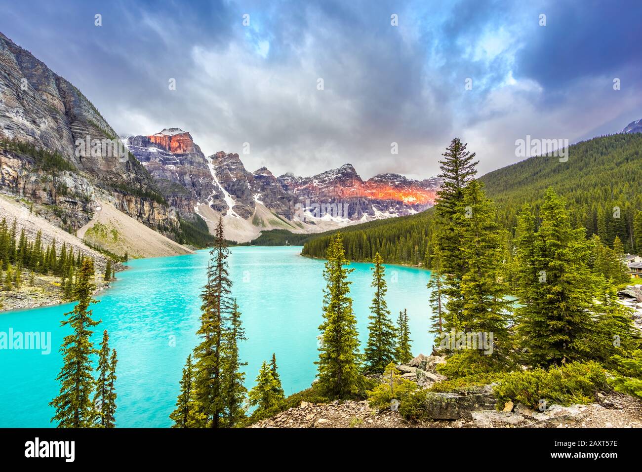 Lac Moraine avec de belles montagnes illuminantes dans le dos, Alberta, Canada Banque D'Images