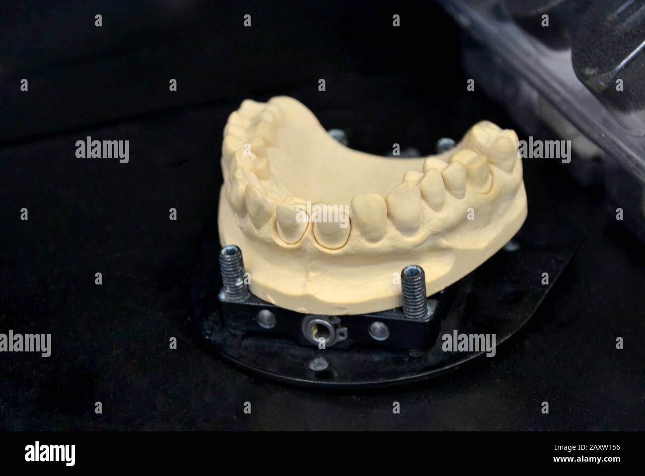 modèle de dents humaines du gros plan de la mâchoire humaine Banque D'Images